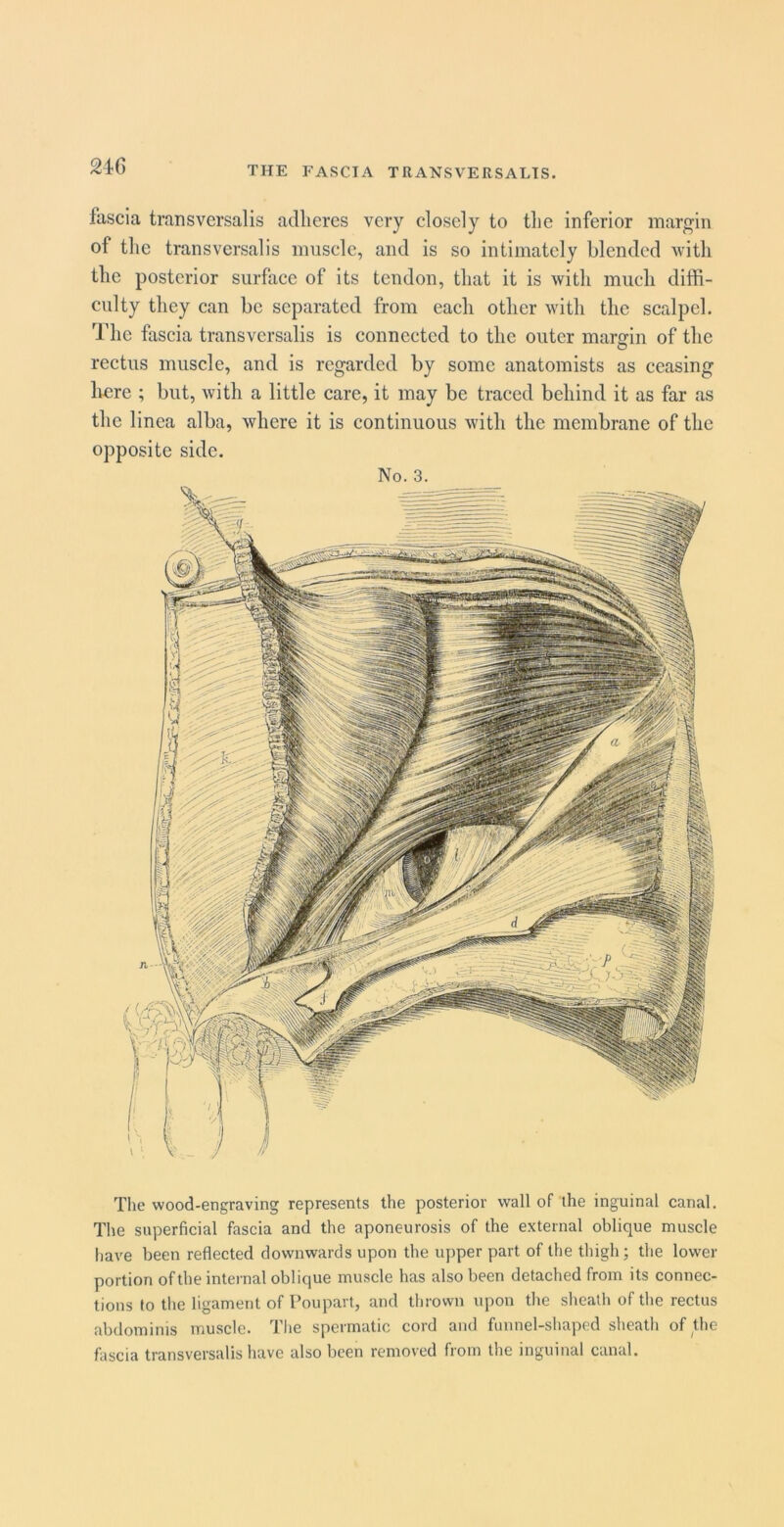 21G fascia transversalis adheres very closely to the inferior margin of the transversalis muscle, and is so intimately blended with the posterior surface of its tendon, that it is with much diffi- culty they can be separated from each other with the scalpel. The fascia transversalis is connected to the outer maririn of the rectus muscle, and is regarded by some anatomists as ceasing liere ; but, with a little care, it may be traced behind it as far as the linea alba, where it is continuous with the membrane of the opposite side. No. 3. Tlie wood-engraving represents the posterior wall of the inguinal canal. The superficial fascia and the aponeurosis of the e.xternal oblique muscle have been reflected downwards upon the upper part of tlie thigh; tlie lower portion of the internal oblique inu.scle has also been detached from its connec- tions to the ligament of Poupart, and thrown upon the slieath of the rectus abdominis muscle. The spermatic cord and fiinnel-sliaped sheath of the fascia transversalis have also been removed from the inguinal canal.