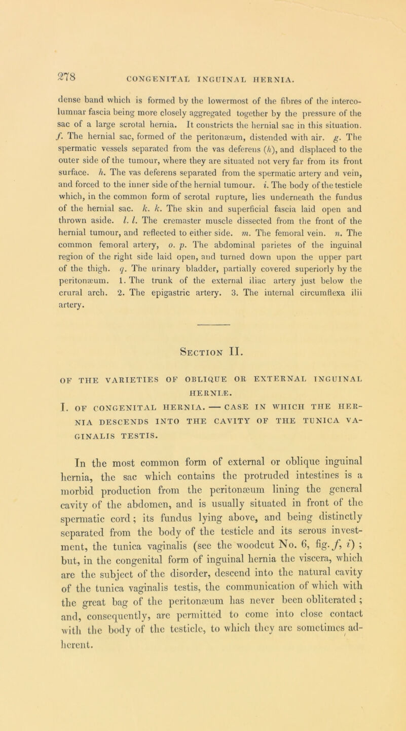 dense band which is formed by the lowermost of the fibres of the interco- lumnar fascia being more closely aggregated together by the pressure of the sac of a large scrotal hernia. It constricts the hernial sac in this situation. /. The hernial sac, formed of the peritona?um, distended with air. g. The spermatic vessels separated from the vas deferens (/<), and displaced to the outer side of the tumour, where they are situated not very far from its front surface. A. The vas deferens separated from the spermatic artery and vein, and forced to the inner side of the hernial tumour, i. The body of the testicle which, in the common form of scrotal rupture, lies underneath the fundus of the hernial sac. k. k. The skin and superficial fascia laid open and thrown aside. 1. 1. The cremaster muscle dissected from the front of the hernial tumour, and reflected to either side. m. The femoral vein. n. The common femoral artery, o. p. The abdominal parietes of the inguinal region of the right side laid open, mid turned down upon the upper part of the thigh, q. The urinary bladder, partially covered superiorly by the peritonaeum. 1. The trunk of the external iliac artery just below the crural arch. 2. The epigastric artery. 3. The internal circumflexa ilii artery. Section II. OF THE VARIETIES OF OBLIQUE OR EXTERNAL INGUINAL HERNI.E. I. OF CONGENITAL HERNIA. CASE IN WHICH THE HER- NIA DESCENDS INTO THE CAVITY OF THE TUNICA VA- GINALIS TESTIS. In the most common form of external or oblique inguinal hernia, the sac which contains the protruded intestines is a morbid production from the peritonteum lining the general cavity of the abdomen, and is usually situated in front of the spermatic cord; its fundus lying above, and being distinctly separated from the body of the testiele and its serous invest- ment, the tunica vaginalis (see the woodcut No. 6, fig./, i) ; but, in the congenital form of inguinal hernia the viscera, which are the subject of the disorder, descend into the natural cavity of the tunica vaginalis testis, the communication of which with the great bag of the peritonaeum has never been obliterated ; and, consequently, are permitted to come into dose contact with the body of the testicle, to which they arc sometimes ad- herent.