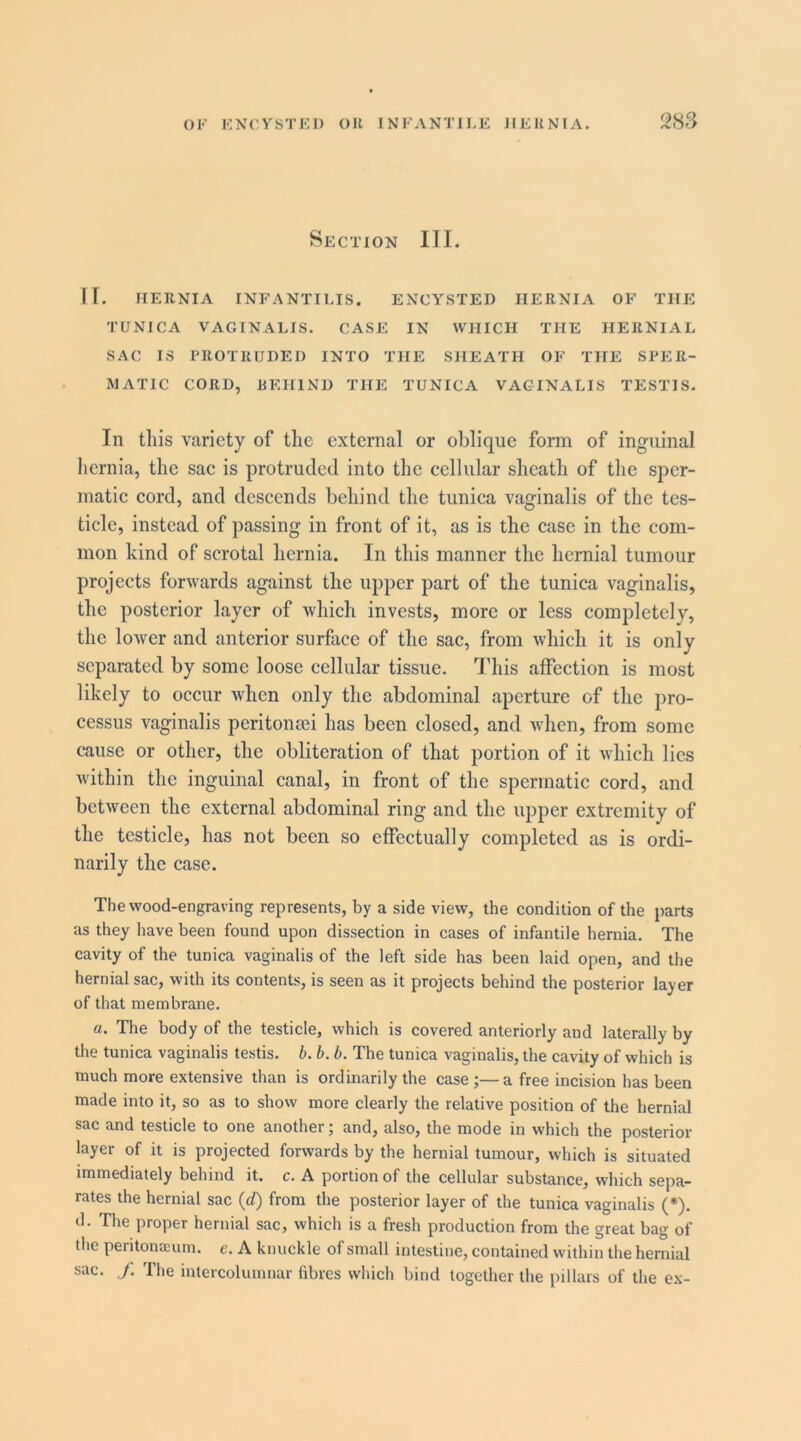 Section III. II. HERNIA INFANTILIS. ENCYSTED HERNIA OF THE TUNICA VAGINALIS. CASE IN WHICH THE HERNIAL SAC IS PROTRUDED INTO THE SHEATH OF THE SPER- MATIC CORD, REHIND THE TUNICA VAGINALIS TESTIS. In tliis variety of the external or oblique form of inguinal hernia, the sae is protruded into the cellular sheath of the sper- niatie cord, and descends behind the tunica vaginalis of the tes- ticle, instead of passing in front of it, as is the case in the com- mon kind of scrotal hernia. In this manner the hernial tumour projects forwards against the upper part of the tunica vaginalis, the posterior layer of which invests, more or less completely, the lower and anterior surface of the sac, from which it is only separated by some loose cellular tissue. This affection is most likely to occur when only the abdominal aperture of the pro- cessus vaginalis peritonsei has been closed, and when, from some cause or other, the obliteration of that portion of it which lies within the inguinal canal, in front of the spermatic cord, and between the external abdominal ring and the upper extremity of the testicle, has not been so effectually completed as is ordi- narily the case. The wood-engraving represents, by a side view, the condition of the parts as they have been found upon dissection in cases of infantile hernia. The cavity of the tunica vaginalis of the left side has been laid open, and the hernial sac, with its contents, is seen as it projects behind the posterior layer of that membrane. a. The body of the testicle, which is covered anteriorly and laterally by the tunica vaginalis testis, b. b. b. The tunica vaginalis, the cavity of which is much more extensive than is ordinarily the case ;— a free incision has been made into it, so as to show more clearly the relative position of the hernial sac and testicle to one another; and, also, the mode in which the posterior- layer of it is projected forwards by the hernial tumour, which is situated immediately behind it. c. A portion of the cellular substance, which sepa- rates the hernial sac (d) from the posterior layer of the tunica vaginalis (*). d. The proper hernial sac, which is a fresh production from the great bag of the peritonaeum, c. A knuckle of small intestine, contained within the hernial sac. J. The inlercolumnar fibres which bind together the pillars of the e.\-