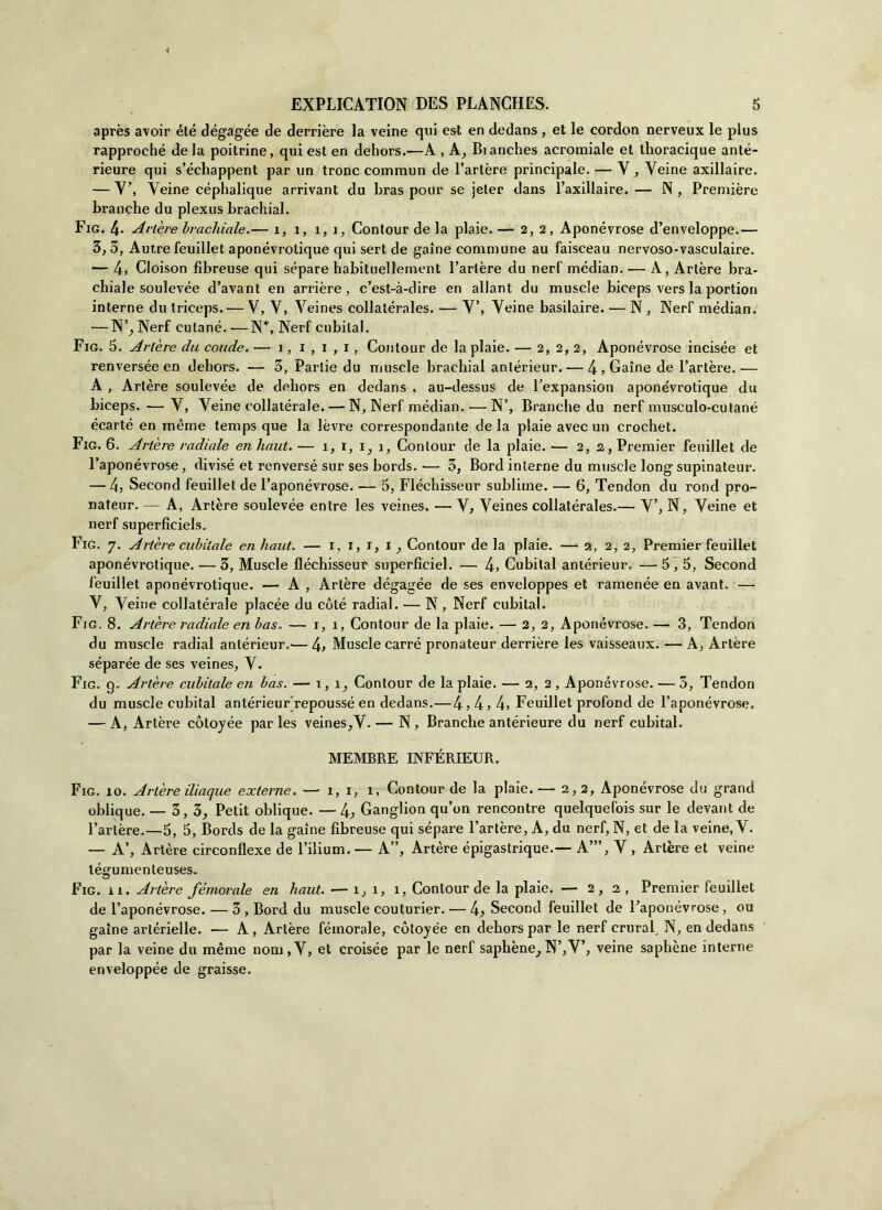 après avoir été dégagée de derrière la veine qui est en dedans, et le cordon nerveux le plus rapproché de la poitrine, qui est en dehors.—A , A, Bianches acromiale et thoracique anté- rieure qui s’échappent par un tronc comraun de l’artère principale. — Y , Yeine axillaire. — Y\ Yeine céphalique arrivant du bras pour se jeter dans l’axillaire. — N, Première branche du plexus brachial. Fig. 4- Avière brachiale.— 1, 1, 1, 1, Contour de la plaie. — 2,2, Aponévrose d’enveloppe.— 3, 3, Autre feuillet aponévrolique qui sert de gaine commuiie au faisceau nervoso-vasculaire. — 4, Cloison fìbreuse qui séparé habituellement l’artère du nerf médian. — A, Artère bra- chiale soulevée d’avant en arcière, c’est-à-dire en allant du muscle biceps vers la portion interne du triceps. — V, V, Yeines collatérales. — V’, Yeine basilaire. — N , Nerf médian. — N’, Nerf cutané. —N*, Nerf cubila!. Fig. 5. Artère du coude. — 1, 1 , 1 , 1, Contour de la plaie. — 2, 2, 2, Aponévrose incisée et renversée en dehors. — 3, Partie du muscle brachial antérieur. — 4 ? Gaine de l’artère.— A, Artère soulevée de dehors en dedans , au-dessus de Fexpansion aponévrotique du biceps. — V, Yeine collaterale. — N, Nerf médian. ■— N’, Branche du nerf musculo-culané écarté en mème temps que la lèvre correspondante de la plaie avec un crochet. Fig. 6. Artère radiale en haut. — 1,1,1, 1, Contour de la plaie. — 2, 2, Premier feuillet de l’aponévrose, divise et renversé sur ses bords.— 3, Bord interne du muscle long supinateur. — 4) Second feuillet de l’aponévrose. — 5, Fléchisseur sublime. — 6, Tendon du rond pro- nateur. — A, Artère soulevée entre les veines, — Y, Yeines collatérales.— Y’, N, Yeine et nerf superficiels. Fig. 7. Artère cubitale en haut. — 1, 1, 1, 1, Contour de la plaie. — a, 2, 2, Premier feuillet aponévrotique. — 3, Muscle fléchisseur superficiel. — 4> Cubilal antérieur. — 5,5, Second feuillet aponévrotique. — A , Artère dégagée de ses enveloppes et ramenée en avant. — Y, Yeine collatérale placée du coté radiai. — N , Nerf cubital. Fig. 8. Artère radiale en bas„ — 1,1, Contour de la plaie. — 2, 2, Aponévrose. — 3, Tendon du muscle radiai antérieur.— 4> Muscle carré pronateur derrière les vaisseaux. — A, Artère séparée de ses veines, Y. Fig. 9. Artère cubitale en bas. —- 1, 1, Contour de la plaie. — 2, 2 , Aponévrose. — 5, Tendon du muscle cubital antérieur’repoussé en dedans.—4? 4> 4» Feuillet profond de l’aponévrose. — A, Artère còtoyée par les veines,Y. — N , Branche antérieure du nerf cubital. MEMBRE INFÉRIEUR. Fig. io. Artère iliaque externe. — r, 1, 1, Contour de la plaie.— 2,2, Aponévrose du grand oblique. — 3,3, Petit oblique. — 4> Ganglion qu’on rencontre quelquefois sur le devant de Fartère.—5, 5, Bords de la gaine fibreuse qui séparé l’artère, A, du nerf, N, et de la veine, Y. — A’, Artère circonflexe de l’ilium. — A”, Artère épigastrique.— A’”, Y , Artère et veine légumenleuses. Fig. ìi. Artère femorale en haut. — 1, 1, 1, Contour de la plaie. — 2,2, Premier feuillet de l’aponévrose. — 3 , Bord du muscle couturier. — Second feuillet de Faponévrose , ou gaine arlérielle. — A, Artère fémorale, còtoyée en dehors par le nerf crural, N, en dedans par la veine du mème nom,Y, et croisée par le nerf saphène, N’,Y’, veine saphène interne enveloppée de graisse.