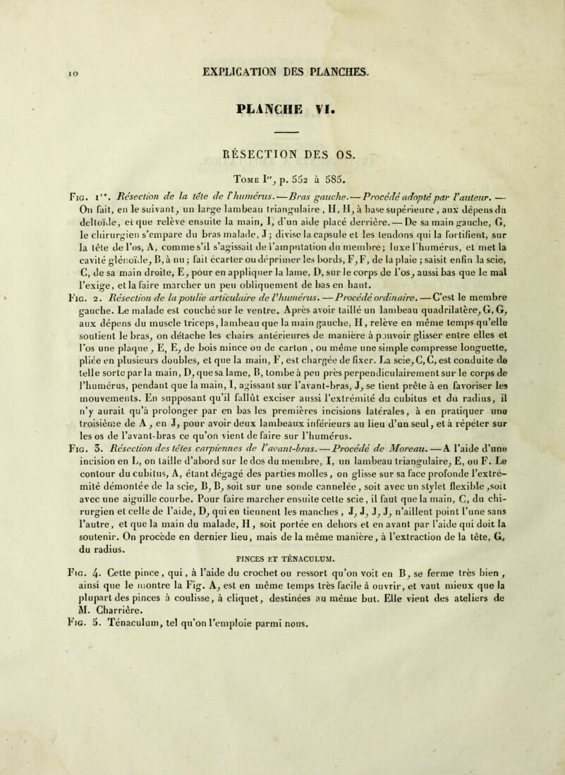 PLANCHE VI. RÉSECTION DES OS. Tome Icr_, p. 552 à 585. Eig. ire. Résection de la téle de rhumérus.—Bras gauche.— Procède adnptépar l’auteur.— On Tait, en le suivant, un large lambeau triangolane , H, PI, à base supérieure , aux dépens du deltoide, ei que relève ensuile la mairi, I, d’un aide piace derrière.— De sa main gauche, G, le chirurgico s’empare du bras ìnalade, J ; divise la capsule et Ics lendons qui la fortifient, sur la lète de l’os, A, commes’il s’agissail de l’ainputalion du membre; luxe rhumérus, et met la cavile glénoi'Je^ B,à nu ; fait écarler ou deprimer les bords, F^F, de la plaie ; saisit enfin la scie, C, de sa main clroite, E,, pour en appliquer la lame, D, sur le eorps de l’os^ aussi bas que le mal l’exige, et la Taire inarcher un peu obliquement de bas en haut. Fig. 2. Résection de la poulie articulaire de rhumérus. —Procède or din aire. —G’est le membre gauche. Le malarie est couché sur le ventre. Après avoir taillé un lambeau quadrilatere^ G, G, aux dépens du inuscle Iriceps,lambeau que la mairi gauche. PI, relève en mème temps qu’elle soulient le bras, on délache les chairs anlérieures de manière à pouvoir glisser enire elles et Fos une plaque y E, E, de bois mince ou de carton , ou méme unesimple compresse longuette, pliée en plusieurs doubles, et que la main, F, est chargée de fixcr. La scie^C, C, est conduite de telle sorte par la main, D^ que sa lame, B, tombe à peu près perpendiculairement sur le eorps de l’humérus, pendant que la main, I, agissant sur Favant-bras, J, se tient prète à en favoriser les mouvemenls. En supposant qu’il fallut exciser aussi l’extrémilé du cubitus et du radius, il n’y aurait qu’à prolonger par en bas les premières incisions latérales, à en pratiquer une troisième de A , en J, pour avoir deux lambeaux inférieurs au lieu cl’un seul, et à répéter sur les os de Favant-bras ce qu’on vient de Taire sur Fhumcrus. Fig. 3. Résection destéles ca/piennes de Vavanl-bras. — Procédé de Moreau.—A Faide cFune ineision en L, on laille d’abord sur le dos du membre, I, un lambeau triangulaire, E, ou F. Le conlour du cubitus, A, étant dégagé des parties molles, on glisse sur sa Tace profonde l’extré- milé démonlée de la scie, B, B, soit sur une sonde cannelée, soit avec un slylel flexible ,soit avec une aiguille courbe. Pour Taire marcher ensuite cette scie, il Taut que la main, G, du chi- rurgien et celle de Faide, D, qui en tiennent les manches , J, J, J, n’aillent point Fune sans l’autre, et que la main du malade, IP, soit portée en dehors et en avant par l’aide qui doit la soutenir. On procède en dernier lieu, mais de la mème manière, à l’extraction de la téle, G, du radius. PINCES ET TÉNACULUM. Fig. 4- Cette pince, qui, à Faide du crochet ou ressort qu’on volt en B^ se ferme très bien , ainsi que le montre la Fig. K, est en mème temps très Tacile à ouvrir, et vaut mieux que la plupart des pinces à coulisse, à cliquet, destinées au mème but. Elle vient des ateliers de M. Charrière. Fig. 5. Ténaculum, tei qu’on Femploie parmi nous.