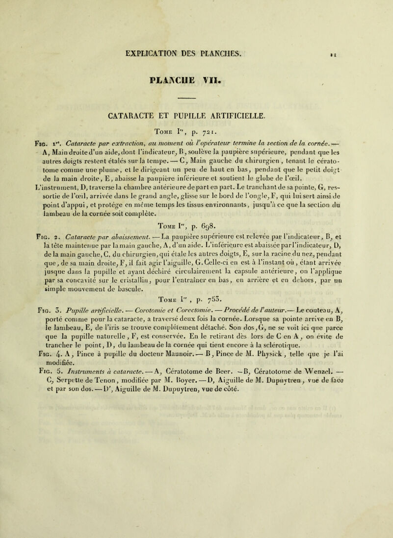 11 PLAiACUE VII. CATARACTE ET PUPILLE ARTIFICIELLE. Tome Icr, p. 721. Fig. r°. Cataracte par eoetraction, au moment où Vopérateur termine la section de la cornee.— A, Maiodroited’un aide,dont Findicateur, B,soulcve la paupière supérieure, pendant queles aulres doigts reslent étalés surla tempe. — C, Main gauche du chirurgico , tenanl le céralo- lome cornine urie piume, et le dirigeant un peu de haut en bas, pendant que le petit doigt de la main droile, E, abaisse la paupière inférieure et soutient le globe de PoeiL L’instrmnent, D, traverse la chambre anlérieure depart en part. Le tranchant de sa pointe, G, res- sortie de l’oeil, arrivée dans le grand angle, glisse sur le bord de l’ongle^ F, qui lui sert ainsi de point d’appui, et protége en mème lemps les lissus environnants, jusqu’à ce que la section du lambeau de la cornée soit complète. Tome I, p. 698. Fig. 2. Cataracte par abaissement. —La paupière supérieure est relevée par l’indicaleur. Ih, et la tòte maintenue par lamain gauche, A, d’un aide. L’inPérieure est abaisséeparl’indicateur, D, de la main gauche, G, du chirurgico, qui diale les autres doigts, E, sur la racine du nez, pendant que, de sa main droile_, F_, il fait agir Faiguille, G.Gelle-ci en est à Finstant où., étant arrivée jusque dans la pupille et. ayant déchiré circulairement la capsule anlérieure, on l’applique parsa concavité sur le cristalli», pour Fentrainer en bas, en arrière et en dehors, par un simple mouvement de bascule. Tome 1 , p. 755. Fig. 5. Pupille artificielle. ■— Corotomie et Coreclomie. —Procède de Vauteur.— Le contea u: A; porté corame pour la cataracte, a traversò deux Pois la cornée. Lorsque sa pointe arrive en B^ le lambeau, E, de Firis se trouve compléleinent détaché. Son dos^G, ne se voit ici que parce que la pupille naturelle , F, est conservée. E11 le retirant dès lors de C en A,, on évite de trancher le point, D, du lambeau de la cornée qui tierit encore à la sclérolique. Fig. 4* A_, Pince à pupille du docteur Maunoir. ■— B; Pince de M. Physick , telle que je Fai modifiée. Fig. 5. Instruments a cataracte. — A^ Gératotome de Beer. — B^, Gératotome de Wenzel. — C, Serpette de Tenon, modihée par M. Boyer.—D, Aiguille de M. Dupuytren^ vue de Pace et par son dos. — IP, Aiguille de M. Dupuylren, vue de coté.