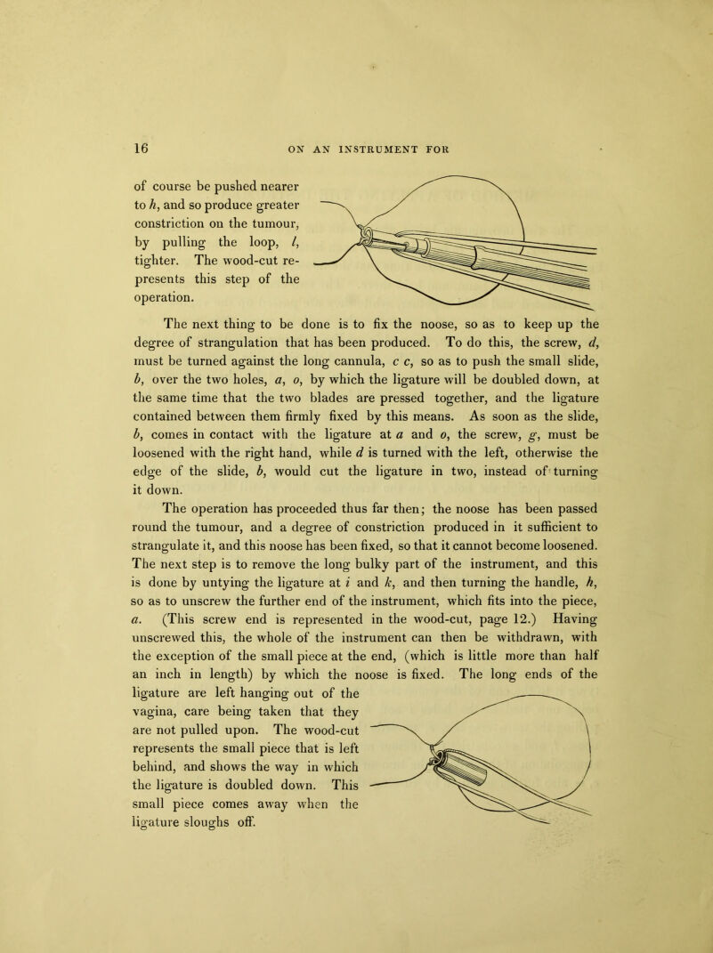 of course be pushed nearer to h, and so produce greater constriction on the tumour, by pulling the loop, /, tighter. The wood-cut re- presents this step of the operation. The next thing to be done is to fix the noose, so as to keep up the degree of strangulation that has been produced. To do this, the screw, d, must be turned against the long cannula, c c, so as to push the small slide, b, over the two holes, a, o, by which the ligature will be doubled down, at the same time that the two blades are pressed together, and the ligature contained between them firmly fixed by this means. As soon as the slide, b, comes in contact with the ligature at a and o, the screw, g, must be loosened with the right hand, while d is turned with the left, otherwise the edge of the slide, b, would cut the ligature in two, instead of turning it down. The operation has proceeded thus far then; the noose has been passed round the tumour, and a degree of constriction produced in it sufficient to strangulate it, and this noose has been fixed, so that it cannot become loosened. The next step is to remove the long bulky part of the instrument, and this is done by untying the ligature at i and k, and then turning the handle, h, so as to unscrew the further end of the instrument, which fits into the piece, a. (This screw end is represented in the wood-cut, page 12.) Having unscrewed this, the whole of the instrument can then be withdrawn, with the exception of the small piece at the end, (which is little more than half an inch in length) by which the noose is fixed. The long ends of the ligature are left hanging out of the vagina, care being taken that they are not pulled upon. The wood-cut represents the small piece that is left behind, and shows the way in which the ligature is doubled down. This small piece comes away when the ligature sloughs off.