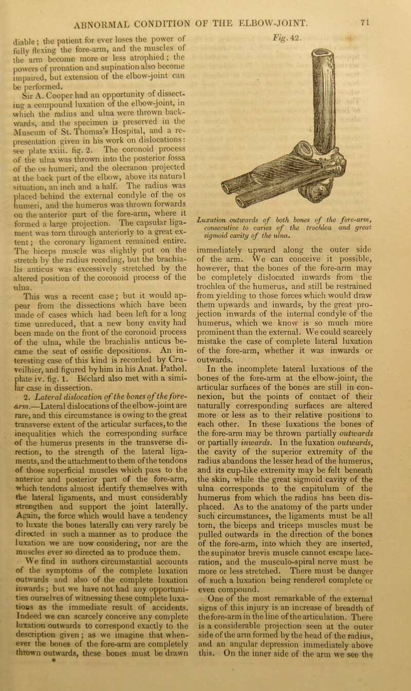 diable; the patient for ever loses the power of fully flexing the fore-arm, and the muscles of the arm become more or less atrophied; the powers of pronation and supination also become impaired, but extension of the elbow-joint can be performed. Sir A. Cooper had an opportunity of dissect- ing a compound luxation of the elbow-joint, in which the radius and ulna were thrown back- wards, and the specimen is preserved in the Museum of St. Thomas’s Hospital, and a re- presentation given in his work on dislocations: see plate xxiii. tig. 2. The coronoid process of the ulna was thrown into the posterior fossa of the os humeri, and the olecranon projected at the back part of the elbow, above its natural situation, an inch and a half. The radius was placed behind the external condyle of the os humeri, and the humerus was thrown forwards on the anterior part of the fore-arm, where it formed a large projection. The capsular liga- ment was torn through anteriorly to a great ex- tent ; the coronary ligament remained entire. The biceps muscle was slightly put on the stretch by the radius receding, but the brachia- lis anticus was excessively stretched by the altered position of the coronoid process of the ulna. This was a recent case; but it would ap- pear from the dissections which have been made of cases which had been left for a long time unreduced, that a new bony cavity had been made on the front of the coronoid process of the ulna, while the brachialis anticus be- came the seat of ossific depositions. An in- teresting case of this kind is recorded by Cru- veilhier, and figured by him in his Anat. Pathol, plate iv. fig. 1. Bedard also met with a simi- lar case in dissection. 2. Lateral dislocation of the hones of the fore- arm.—Lateral dislocations of the elbow-joint are rare, and this circumstance is owing to the great transverse extent of the articular surfaces, to the inequalities which the corresponding surface of the humerus presents in the transverse di- rection, to the strength of the lateral liga- ments, and the attachment to them of the tendons of those superficial muscles which pass to the anterior and posterior part of the fore-arm, which tendons almost identify themselves with the lateral ligaments, and must considerably strengthen and support the joint laterally. Again, the force which would have a tendency to luxate the bones laterally can very rarely be directed in such a manner as to produce the luxation we are now considering, nor are the muscles ever so directed as to produce them. We find in authors circumstantial accounts of the symptoms of the complete luxation outwards and also of the complete luxation inwards ; but we have not had any opportuni- ties ourselves of witnessing these complete luxa- tions as the immediate result of accidents. Indeed we can scarcely conceive any complete luxation outwards to correspond exactly to the description given; as we imagine that when- ever the bones of the fore-arm are completely thrown outwards, these bones must be drawn Luxation outwards of both bones of the fore-arm, consecutive to caries of the trochlea and great sigmoid cavity of the ulna. immediately upward along the outer side of the arm. We can conceive it possible, however, that the bones of the fore-arm may be completely dislocated inwards from the trochlea of the humerus, and still be restrained from yielding to those forces which would draw them upwards and inwards, by the great pro- jection inwards of the internal condyle of the humerus, which we know is so much more prominent than the external. We could scarcely mistake the case of complete lateral luxation of the fore-arm, whether it was inwards or outwards. In the incomplete lateral luxations of the bones of the fore-arm at the elbow-joint, the articular surfaces of the bones are still in con- nexion, but the points of contact of their naturally corresponding surfaces are altered more or less as to their relative positions to each other. In these luxations the bones of the fore-arm may be thrown partially outwards or partially inwards. In the luxation outwards, the cavity of the superior extremity of the radius abandons the lesser head of the humerus, and its cup-like extremity may be felt beneath the skin, while the great sigmoid cavity of the ulna corresponds to the capitulum of the humerus from which the radius has been dis- placed. As to the anatomy of the parts under such circumstances, the ligaments must be all torn, the biceps and triceps muscles must be pulled outwards in the direction of the bones of the fore-arm, into which they are inserted, the supinator brevis muscle cannot escape lace- ration, and the musculo-spiral nerve must be more or less stretched. There must be danger of such a luxation being rendered complete or even compound. One of the most remarkable of the external signs of this injury is an increase of breadth of the fore-arm in the line of the articulation. There is a considerable projection seen at the outer side of the arm formed by the head of the radius, and an angular depression immediately above this. On the inner side of the arm we see the