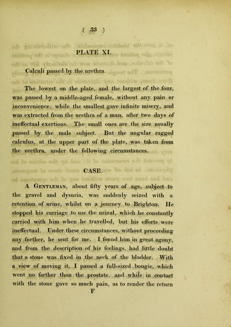 PLATE XI. Calculi passed by the urethra. The lowest on the plate, and the largest of the four, was passed by a middle-aged female, without any pain or inconvenience; while the smallest gave infinite misery, and was extracted from the urethra of a man, after two days of ineffectual exertions. The small ones are the size usually passed by the male subject. But the angular ragged calculus, at the upper part of the plate, was taken from the urethra, under the following circumstances. CASE. A Gentleman, about fifty years of age, subject to the gravel and dysuria, was suddenly seized with a retention of urine, whilst on a journey to Brighton. He stopped his carriage to use the urinal, which he constantly carried with him when he travelled, but his efforts were ineffectual. Under these circumstances, without proceeding any further, he sent for me. I found him in great agony, and from the description of his feelings, had little doubt that a stone was fixed in the neck of the bladder. With a view of moving it, I passed a full-sized bougie, which went no farther than the prostate, and while in contact with the stone gave so much pain, as to render the return F