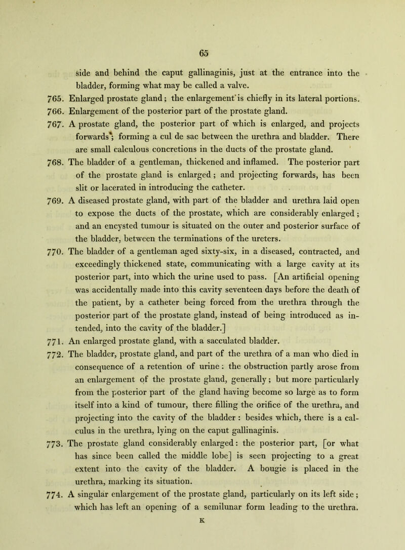 side and behind the caput gallinaginis, just at the entrance into the bladder, forming what may be called a valve. 765. Enlarged prostate gland; the enlargement'is chiefly in its lateral portions. 766. Enlargement of the posterior part of the prostate gland. 767- A prostate gland, the posterior part of which is enlarged, and projects forwards* forming a cul de sac between the urethra and bladder. There are small calculous concretions in the ducts of the prostate gland. 768. The bladder of a gentleman, thickened and inflamed. The posterior part of the prostate gland is enlarged ; and projecting forwards, has been slit or lacerated in introducing the catheter. 769. A diseased prostate gland, with part of the bladder and urethra laid open to expose the ducts of the prostate, which are considerably enlarged ; and an encysted tumour is situated on the outer and posterior surface of the bladder, between the terminations of the ureters. 770. The bladder of a gentleman aged sixty-six, in a diseased, contracted, and exceedingly thickened state, communicating with a large cavity at its posterior part, into which the urine used to pass. [An artificial opening was accidentally made into this cavity seventeen days before the death of the patient, by a catheter being forced from the urethra through the posterior part of the prostate gland, instead of being introduced as in- tended, into the cavity of the bladder.] 771. An enlarged prostate gland, with a sacculated bladder. 772. The bladder, prostate gland, and part of the urethra of a man who died in consequence of a retention of urine: the obstruction partly arose from an enlargement of the prostate gland, generally; but more particularly from the posterior part of the gland having become so large as to form itself into a kind of tumour, there filling the orifice of the urethra, and projecting into the cavity of the bladder : besides which, there is a cal- culus in the urethra, lying on the caput gallinaginis. 773. The prostate gland considerably enlarged: the posterior part, [or what has since been called the middle lobe] is seen projecting to a great extent into the cavity of the bladder. A bougie is placed in the urethra, marking its situation. 774. A singular enlargement of the prostate gland, particularly on its left side; which has left an opening of a semilunar form leading to the urethra. K