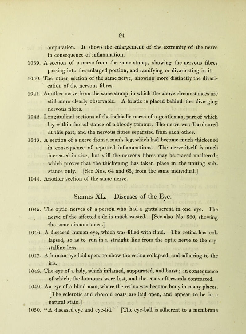 amputation. It shows the enlargement of the extremity of the nerve in consequence of inflammation. 1039. A section of a nerve from the same stump, showing the nervous fibres passing into the enlarged portion, and ramifying or divaricating in it. 1040. The other section of the same nerve, showing more distinctly the divari- cation of the nervous fibres. 1041. Another nerve from the same stump, in which the above circumstances are still more clearly observable. A bristle is placed behind the diverging nervous fibres. 1042. Longitudinal sections of the ischiadic nerve of a gentleman, part of which lay within the substance of a bloody tumour. The nerve was discoloured at this part, and the nervous fibres separated from each other. 1043. A section of a nerve from a man’s leg, which had become much thickened in consequence of repeated inflammations. The nerve itself is much increased in size, but still the nervous fibres may be traced unaltered; which proves that the thickening has taken place in the uniting sub- stance only. [See Nos. 64 and 65, from the same individual.] 1044. Another section of the same nerve. Series XL. Diseases of the Eye. 1045. The optic nerves of a person who had a gutta serena in one eye. The nerve of the affected side is much wasted. [See also No. 680, showing the same circumstance.] 1046. A diseased human eye, which was filled with fluid. The retina has col- lapsed, so as to run in a straight line from the optic nerve to the cry- stalline lens. 1047- A human eye laid open, to show the retina collapsed, and adhering to the iris. 1048. The eye of a lady, which inflamed, suppurated, and burst; in consequence of which, the humours were lost, and the coats afterwards contracted. 1049. An eye of a blind man, where the retina was become bony in many places. [The sclerotic and choroid coats are laid open, and appear to be in a natural state.] 1050. “A diseased eye and eye-lid.” [The eye-ball is adherent to a membrane