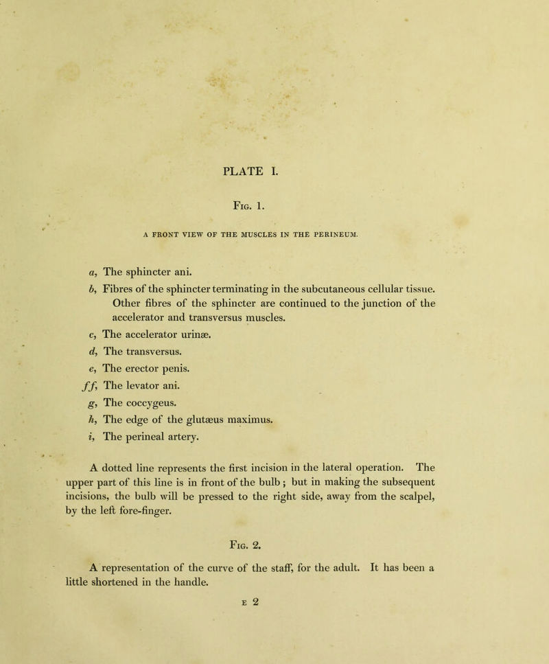 Fig. 1. A FRONT VIEW OF THE MUSCLES IN THE PERINEUM. a, The sphincter ani. b, Fibres of the sphincter terminating in the subcutaneous cellular tissue. Other fibres of the sphincter are continued to the junction of the accelerator and transversus muscles. c, The accelerator urinse. d, The transversus. e, The erector penis. ff, The levator ani. g, The coccygeus. h, The edge of the glutaeus maximus. i, The perineal artery. A dotted line represents the first incision in the lateral operation. The upper part of this line is in front of the bulb ; but in making the subsequent incisions, the bulb will be pressed to the right side, away from the scalpel, by the left fore-finger. Fig. 2. A representation of the curve of the staff, for the adult. It has been a little shortened in the handle.