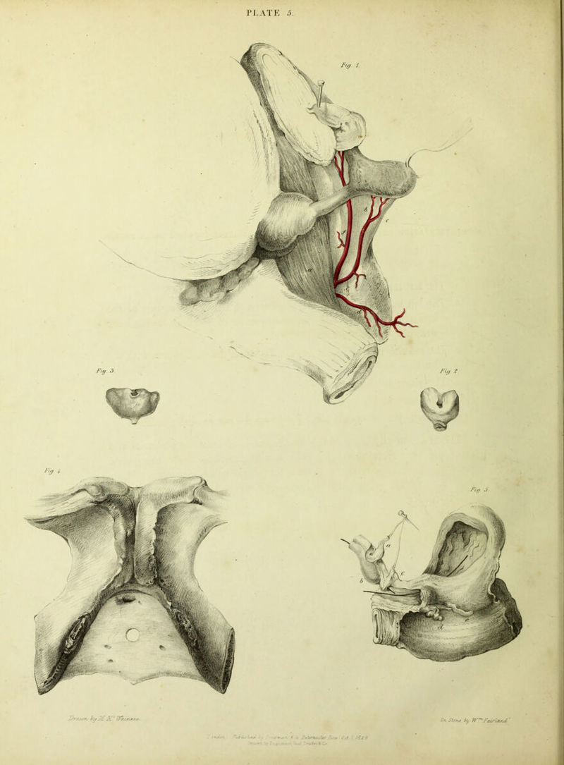 /•V// 2 Fig. i PLATE .5. FU/ 3 :J> v/Mirr iiy jl- M c On Stone by W™ FairUnol.' Fig / Fig. 3 vadon, ' y f - FatwnojlirHou/ Ocl 1 18X9 ; : -;3r. -r >_- :^a£ ?n^d«t JC Co