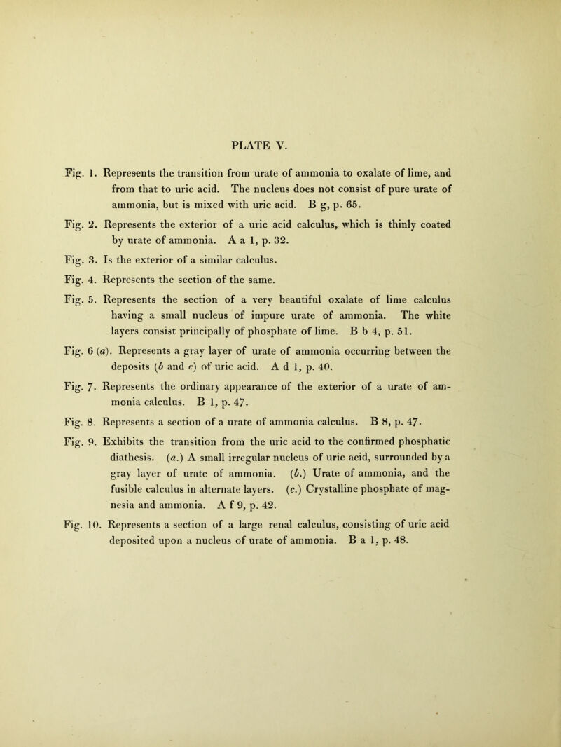 Fig. 1. Represents the transition from urate of ammonia to oxalate of lime, and from that to uric acid. The nucleus does not consist of pure urate of ammonia, hut is mixed with uric acid. B g, p. 65. Fig. 2. Represents the exterior of a uric acid calculus, which is thinly coated by urate of ammonia. A a 1, p. 32. Fig. 3. Is the exterior of a similar calculus. Fig. 4. Represents the section of the same. Fig. 5. Represents the section of a very beautiful oxalate of lime calculus having a small nucleus of impure urate of ammonia. The white layers consist principally of phosphate of lime. B b 4, p. 51. Fig. 6 (a). Represents a gray layer of urate of ammonia occurring between the deposits (b and c) of uric acid. Ad 1, p. 40. Fig. 7- Represents the ordinary appearance of the exterior of a urate of am- monia calculus. B 1, p. 47. Fig. 8. Represents a section of a urate of ammonia calculus. B 8, p. 47- Fig. 9. Exhibits the transition from the uric acid to the confirmed phosphatic diathesis, (a.) A small irregular nucleus of uric acid, surrounded by a gray layer of urate of ammonia. (b.) Urate of ammonia, and the fusible calculus in alternate layers, (c.) Crystalline phosphate of mag- nesia and ammonia. A f 9, p. 42. Fig. 10. Represents a section of a large renal calculus, consisting of uric acid deposited upon a nucleus of urate of ammonia. B a 1, p. 48.