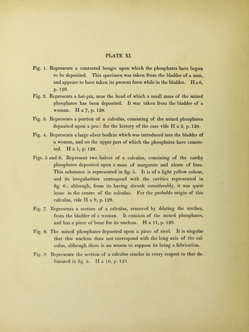 Fig. 1. Represents a contorted bougie upon which the phosphates have begun to be deposited. This specimen was taken from the bladder of a man, and appears to have taken its present form while in the bladder. H a 6, p. 128. Fig. 2. Represents a hat-pin, near the head of which a small mass of the mixed phosphates has been deposited. It was taken from the bladder of a woman. H a 7, p. 128. Fig. 3. Represents a portion of a calculus, consisting of the mixed phosphates deposited upon a pea: for the history of the case vide H a 3, p. 128. Fig. 4. Represents a large silver bodkin which was introduced into the bladder of a woman, and on the upper part of which the phosphates have concre- ted. H a 1, p. 128. Figs. 5 and 6. Represent two halves of a calculus, consisting of the earthy phosphates deposited upon a mass of margarate and oleate of lime. This substance is represented in fig. 5. It is of a light yellow colour, and its irregularities correspond with the cavities represented in fig. 6 ; although, from its having shrunk considerably, it was quite loose in the centre of the calculus. For the probable origin of this calculus, vide H a 9, p. 129. Fig. 7- Represents a section of a calculus, removed by dilating the urethra, from the bladder of a woman. It consists of the mixed phosphates, and has a piece of bone for its nucleus. Ha 11, p. 129. Fig. 8. The mixed phosphates deposited upon a piece of steel. It is singular that this nucleus does not correspond with the long axis of the cal- culus, although there is no reason to suppose its being a fabrication. Fig. 9 Represents the section of a calculus similar in every respect to that de-