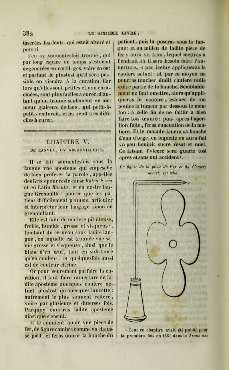 insérées les dents, qui estoit altéré et pourri. I’en ay souuentesfois trouué , qui par long espace de temps s’estoient degenerées en carlil ges, voire en os : et partant le plustost qu’il sera pos- sible on viendra à la curation. Car lors qu’elles sont pptites et non enra- cinées, sont plus faciles à curer, d’au- tant qu’on trouue seulement vn hu- meur glaireux dedans, qui petit-à- petit s’endurcit, et les rend tres-diffi- ciles à curer. CHAPITRE Y. DE RANVLA , OV GRENO VILLETTE. Il se fait souuentesfois sous la langue vne aposteme qui empescbe de bien proférer la parole , appellée des Grecs pour ces! e caus eBatraih um et en Latin Ranula , et en nostre lan- gue Grenouille : pource que les pa- tiens difficilement p 'uuent arliculer et interpréter leur langage sinon en grenouillant. Elle est faite de matière pituiteuse, froide, humide, grosse et visqueuse , tombant du cerueau sous ladite lan- gue , en laquelle est trouuée vne sa- nie grosse et v squeuse , ainsi que le blanc d’vn œuf, tant en substance qu’en couleur , et quelquesfois aussi est de couleur citrine. Or pour seurement parfaire la cu- ration , il faut faire ouuerture de la- dite aposteme auecques cautere ac- tuel , plustost qu’auecques lancette : autrement le plus souuent réitéré, voire par plusieurs et diuerses fois. Parquoy ouuriras ladite aposteme ainsi que s’ensuit. Il le conuient auoir vne piece de fer, de figurecambre comme vn chaus- se-pied, et feras ouurir la bouche du patient, puis la poseras sous la lan- gue : et au milieu de ladite piece de fer y aura vn trou, lequel mettras à l’endroit où il sera besoin faire l’ou- uerture, et par iceluy appliqueras le cautere actuel : et par ce moyen ne pourras toucher dudit cautere nulle autre partie de la bouche. Semblable- ment ne faut omettre, alors qu’appli- queras le cautere, esleuer de ion poulce la tumeur par dessous le men- ton : à celle lin de ne faillir à bien faire ton œuui e : puis apres l’aper- tion faite, feras euacuation delà ma- tière. Et le malade lauera sa bouche d’eau d'orge, en laquelle on aura fait vn peu bouillir sucre rosat et miel. Ce faisant l’vlcere sera guarie lost apres et sans nul accident1. La figure de la piece de Fer et du Cautere actuel, est telle. 1 Tout ce chapitre avait été publié pour la première fois en 1561 dans le Traité dei