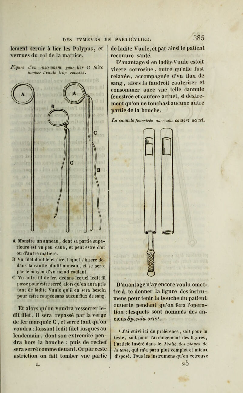 lement seruir à lier les Polypus, et verrues du cul de la matrice. Figure d’vu instrument pour lier et faire tomber l’vuule trop relaxée. A Monstre un anneau, dont sa partie supé- rieure est vn peu caue, et peut estre d’or ou d’autre matière. B Vn filet double et ciré, lequel s’insère de- dans la cauilé dudit anneau , et se serre par le moyen d’vn nœud coulant. C Vn autre fil de fer, dedans lequel ledit fil passe pour estre serré, alors qu’on aura pris tant de ladite Vuule qu’il en sera besoin pour estre coupée sans aucun flux de sang. Et alors qu’on voudra resserrer le- dit filet, il sera repassé par la verge de fer marquée C , et serré tant qu’on voudra : laissant ledit filet iusquesau lendemain , dont son extrémité pen- dra hors la bouche : puis de rechef sera serré comme deuant. Or par ceste aslriction on fait tomber vne partie de ladite Vuule, et par ainsi le patient recouure santé. D’auantagesi en ladite Vuule estoit vlcere corrosiue, outre qu elle fust relaxée, accompagnée d’vn flux de sang , alors la faudroit cautériser et consommer auec vne telle cannule fenestrée etcautere actuel, si dextre- ment qu’on ne touchast aucune autre partie de la bouche. La cannule fenestrée auec son cautere actuel. n D’auantage n’ay encore voulu orne t- tre à te donner la figure des instru- mens pour tenir la bouche du patient ouuerte pendant qu’on fera l’opera- tion : lesquels sont nommés des an- ciens Spécula oris *. 1 J’ai suivi ici de préférence, soit pour le texte, soit pour l’arrangement des figures, l’article inséré dans le Traité des playes de la teste, qui m’a paru plus complet et mieux disposé. Tous les instrumens qu’on retrouve q5 1