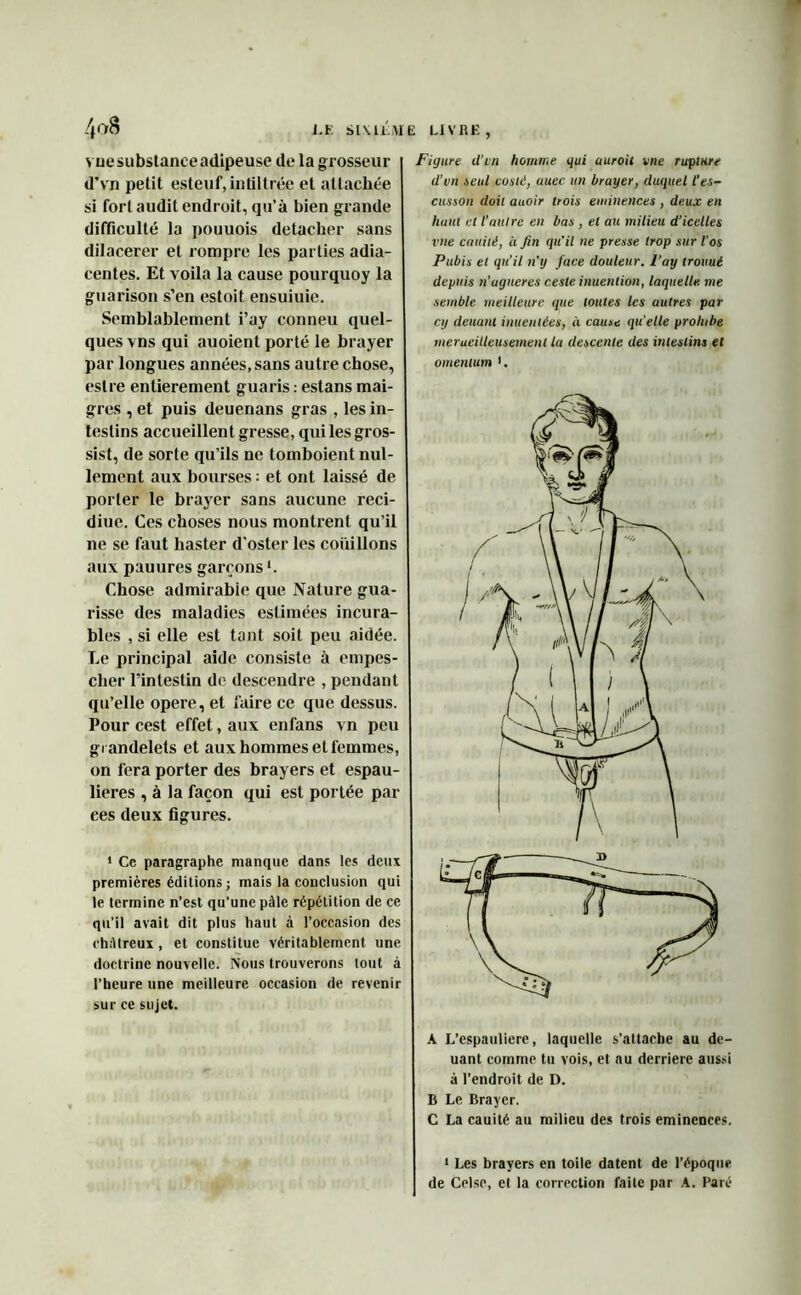 4f>8 LE SIXIEME vue substance adipeuse de la g rosseur d’vn petit esteuf, intiltrée et attachée si fort audit endroit, qu’à bien grande difficulté la pouuois détacher sans dilacerer et rompre les parties adia- centes. Et voila la cause pourquoy la guarison s’en estoit ensuiuie. Semblablement i’ay conneu quel- ques vns qui auoient porté le brayer par longues années, sans autre chose, eslre entièrement guaris : estans mai- gres , et puis deuenans gras , les in- testins accueillent gresse, qui les gros- sist, de sorte qu’ils ne tomboient nul- lement aux bourses : et ont laissé de porter le brayer sans aucune reci- diue. Ces choses nous montrent qu’il ne se faut haster d’oster les coüillons aux pauures garçons Chose admirable que Nature gua- risse des maladies estimées incura- bles , si elle est tant soit peu aidée. Le principal aide consiste à empes- cher l’intestin de descendre , pendant qu’elle opéré, et faire ce que dessus. Pour cest effet, aux enfans vn peu grandelets et aux hommes et femmes, on fera porter des brayers et espau- lieres , à la façon qui est portée pai- res deux figures. < Ce paragraphe manque dans les deux premières éditions; mais la conclusion qui le termine n’est qu’une pâle répétition de ce qu’il avait dit plus haut à l’occasion des chiUreux , et constitue véritablement une doctrine nouvelle. Nous trouverons tout à l’heure une meilleure occasion de revenir sur ce sujet. LIVRE , Figure d’vn homme gui uuroit vue rupture d’vn teul costë, auec un brayer, duquel l'es- cusson doit auoir trois eminences , deux en haut et l’autre en bas , et au milieu d’icelles vue cauité, à fin qu'il ne presse trop sur l’os Pubis et qu’il n’y fuce douleur, l’ay trouué depuis n’ugueres ceste inuenlion, laquelle me semble meilleure que toutes les autres par cij deuant inuenlées, à cause qu’elle prohibe meraeilleusement la descente des intestins et omentum •. A L’espauliere, laquelle s’attache au de- uant comme tu vois, et nu derrière aussi à l’endroit de D. B Le, Brayer. C La cauité au milieu des trois eminences. 1 Les brayers en toile datent de l’époque de Celse, et la correction faite par A. Paré
