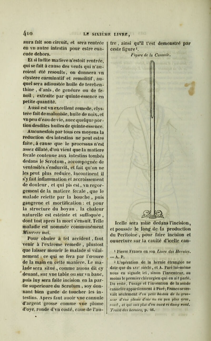 4io LF SI XI LM K LIVRE, aura fait son circuit, et sera rentrée en vn autre intestin pour estre eua- cuée dehors. El si ladite matière n’estoit rentrée, qui se fait à cause des vents qui n’au- roient été resoults, on donnera vn clystere carminatif et remolitif, au- quel sera adioustée huile de tereben- thine , d’anis, de genéure ou de fe- noil , extraite par quinte-essence en petite quantité. Aussi est vn excellent remede, clys- tere fait demaluoisie, huile de noix, et vn peu d’eau de vie, auec quelque por- tion desdites huiles de quinte-essence. Aucunesfois par tous ces moyens la réduction des intestins ne peut estre faite, à cause que le processus n’est assez dilaté, d’où vient que la matière fecale contenue aux intestins tombés dedans le Scrotum, accompagnée de ventosités s'endurcit, et fait qu’on ne les peut plus réduire. Incontinent il s’y fait inflammation et accroissement de douleur, et qui pis est, vn regor- gement de la matière fecale , que le malade reiette par la bouche , puis gangrené et mortification : et pour la structure du boyau , la chaleur naturelle est esteinte et suffoquée , dont tost apres la mort s’ensuit. Telle maladie est nommée communément Miserere mci. Pour obuier à tel accident , faut venir à l’extreme remede , pluslost que laisser mourir le malade si vilai- nement : ce qui se fera par l’œuure de la main en cette maniéré. Le ma- lade sera situé , comme auons dit cy deuant, sur vne table ou sur vn banc, puis luy sera faite incision en la par- tie supérieure du Scrotum , soy don- nant bien garde de toucher les in- testins. Apres faut auoir vne cannule d’argent grosse comme vne plume d’oye, ronde d’Yn costé, cane de l’au- tre , ainsi qu’il l’est demonstré par cesle figure*. Figure de la Cannule. (F\ Icelle sera mise dedans l’incision, et poussée le long de la production du Péritoine, pour faire incision et ouuerture sur la cauité d’icelle can- 1 Pierre Franco en son Lime des Hernies. — A. P. 2 L’opération de la hernie étranglée ne date que du xvr siècle, et A. Paré lui-mème nous en signale ici, sinon l’inventeur, au moins le premierchirurgien qui en ait parlé. Du reste, l’usage et l’invention de la sonde canneléeappartienncnt à Paré; Franco se ser- vait seulement d'vn petit baston de. lu gros- seur d’vue plume d'oie ou vn peu plus gros, rond , et qui soit plut d'vn costi et demi) rond. Traite des hernies, p. 46.