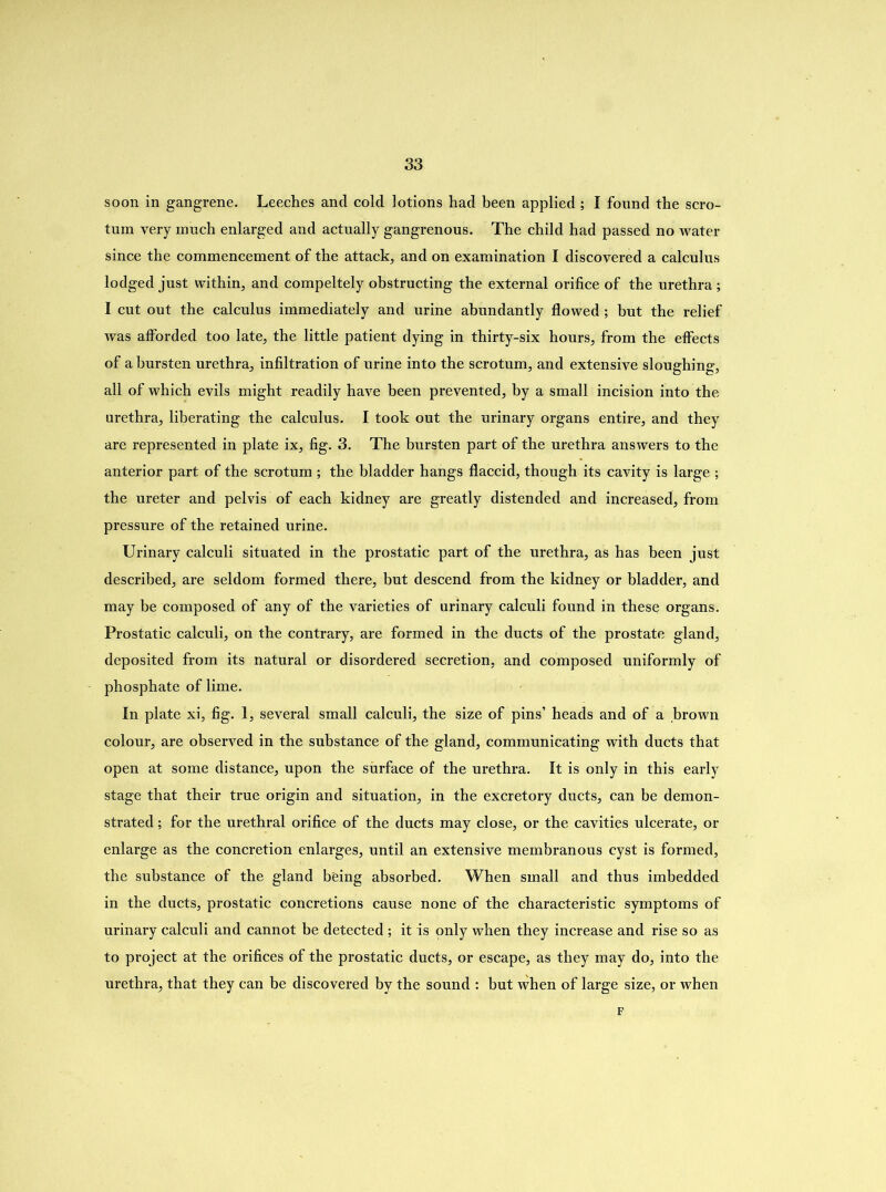 soon in gangrene. Leeches and cold lotions had been applied; I found the scro- tum very much enlarged and actually gangrenous. The child had passed no water since the commencement of the attack, and on examination I discovered a calculus lodged just within, and compeltely obstructing the external orifice of the urethra; I cut out the calculus immediately and urine abundantly flowed ; but the relief was afforded too late, the little patient dying in thirty-six hours, from the effects of a bursten urethra, infiltration of urine into the scrotum, and extensive sloughing, all of which evils might readily have been prevented, by a small incision into the urethra, liberating the calculus. I took out the urinary organs entire, and they are represented in plate ix, fig. 3. The bursten part of the urethra answers to the anterior part of the scrotum ; the bladder hangs flaccid, though its cavity is large ; the ureter and pelvis of each kidney are greatly distended and increased, from pressure of the retained urine. Urinary calculi situated in the prostatic part of the urethra, as has been just described, are seldom formed there, but descend from the kidney or bladder, and may be composed of any of the varieties of urinary calculi found in these organs. Prostatic calculi, on the contrary, are formed in the ducts of the prostate gland, deposited from its natural or disordered secretion, and composed uniformly of phosphate of lime. In plate xi, fig. 1, several small calculi, the size of pins’ heads and of a brown colour, are observed in the substance of the gland, communicating with ducts that open at some distance, upon the surface of the urethra. It is only in this early stage that their true origin and situation, in the excretory ducts, can be demon- strated ; for the urethral orifice of the ducts may close, or the cavities ulcerate, or enlarge as the concretion enlarges, until an extensive membranous cyst is formed, the substance of the gland being absorbed. When small and thus imbedded in the ducts, prostatic concretions cause none of the characteristic symptoms of urinary calculi and cannot be detected ; it is only when they increase and rise so as to project at the orifices of the prostatic ducts, or escape, as they may do, into the urethra, that they can be discovered by the sound : but when of large size, or when F