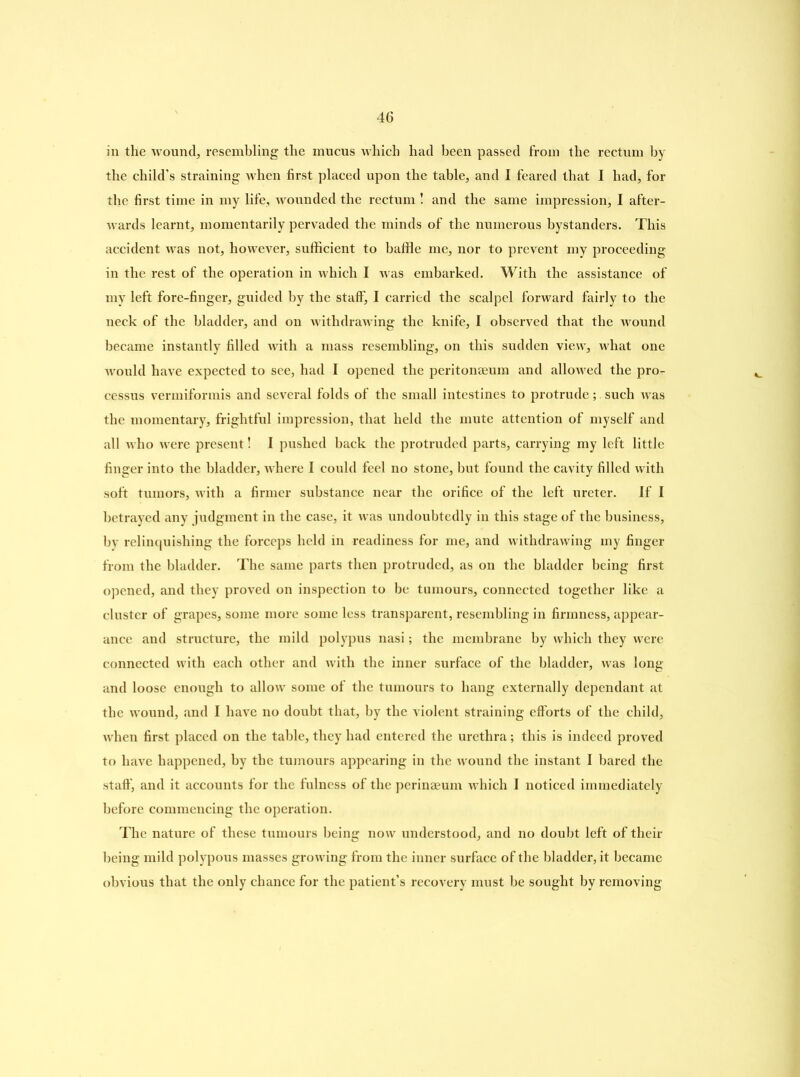 in the wound, resembling the mucus which had been passed from the rectum by the child’s straining when first placed upon the table, and I feared that I had, for the first time in my life, wounded the rectum ! and the same impression, I after- wards learnt, momentarily pervaded the minds of the numerous bystanders. This accident was not, however, sufficient to baffle me, nor to prevent my proceeding in the rest of the operation in which I was embarked. With the assistance of my left fore-finger, guided by the staff, I carried the scalpel forward fairly to the neck of the bladder, and on withdrawing the knife, I observed that the wound became instantly filled with a mass resembling, on this sudden view, what one would have expected to see, had I opened the peritonaeum and allowed the pro^ cessus vermiformis and several folds of the small intestines to protrude; such was the momentary, frightful impression, that held the mute attention of myself and all who were present! I pushed back the protruded parts, carrying my left little finger into the bladder, where I could feel no stone, but found the cavity filled with soft tumors, with a firmer substance near the orifice of the left ureter. If I betrayed any judgment in the case, it was undoubtedly in this stage of the business, by relinquishing the forceps held in readiness for me, and withdrawing my finger from the bladder. The same parts then protruded, as on the bladder being first opened, and they proved on inspection to be tumours, connected together like a cluster of grapes, some more some less transparent, resembling in firmness, appear- ance and structure, the mild polypus nasi; the membrane by which they were connected with each other and with the inner surface of the bladder, was long and loose enough to allow some of the tumours to hang externally dependant at the wound, and I have no doubt that, by the violent straining efforts of the child, when first placed on the table, they had entered the urethra; this is indeed proved to have happened, by the tumours appearing in the wound the instant I bared the staff', and it accounts for the fulness of the perinaeum which I noticed immediately before commencing the operation. The nature of these tumours being now understood, and no doubt left of their being mild polypous masses growing from the inner surface of the bladder, it became obvious that the only chance for the patient’s recovery must be sought by removing