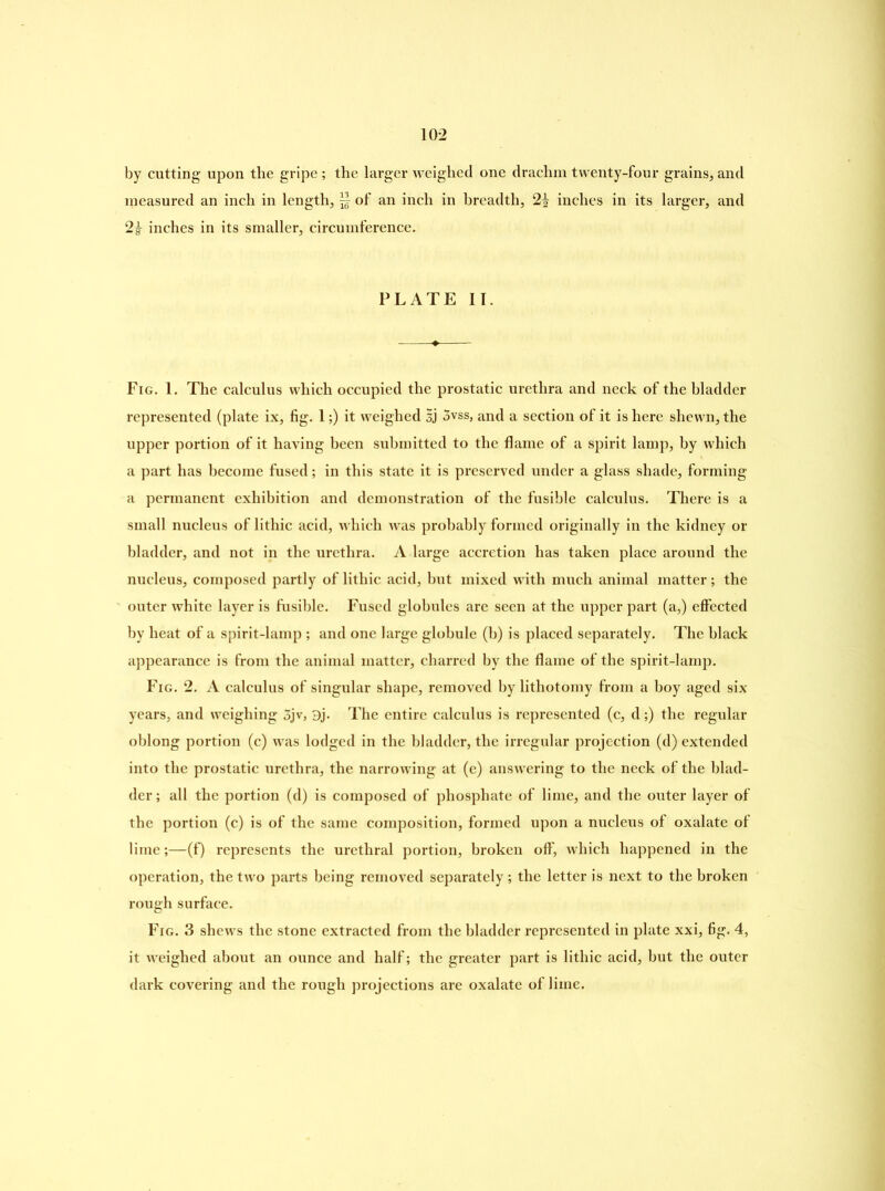by cutting upon the gripe ; the larger weighed one drachm twenty-four grains, and measured an inch in length, jf of an inch in breadth, 2J inches in its larger, and 2£ inches in its smaller, circumference. PLATE II. Fig. 1. The calculus which occupied the prostatic urethra and neck of the bladder represented (plate ix, fig. 1;) it weighed 3vss, and a section of it is here shewn, the upper portion of it having been submitted to the flame of a spirit lamp, by which a part has become fused; in this state it is preserved under a glass shade, forming a permanent exhibition and demonstration of the fusible calculus. There is a small nucleus of lithic acid, which was probably formed originally in the kidney or bladder, and not in the urethra. A large accretion has taken place around the nucleus, composed partly of lithic acid, hut mixed with much animal matter; the outer white layer is fusible. Fused globules are seen at the upper part (a,) effected by heat of a spirit-lamp ; and one large globule (b) is placed separately. The black appearance is from the animal matter, charred by the flame of the spirit-lamp. Fig. 2. A calculus of singular shape, removed by lithotomy from a boy aged six years, and weighing 5jv, 3j. The entire calculus is represented (c, d;) the regular oblong portion (c) was lodged in the bladder, the irregular projection (d) extended into the prostatic urethra, the narrowing at (e) answering to the neck of the blad- der; all the portion (d) is composed of phosphate of lime, and the outer layer of the portion (c) is of the same composition, formed upon a nucleus of oxalate of lime;—(f) represents the urethral portion, broken off, which happened in the operation, the two parts being removed separately; the letter is next to the broken rough surface. Fig. 3 shews the stone extracted from the bladder represented in plate xxi, fig. 4, it weighed about an ounce and half; the greater part is lithic acid, but the outer dark covering and the rough projections are oxalate of lime.