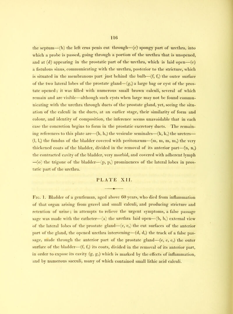the septum—(b) the left crus penis cut through—(c) spongy part of urethra, into which a probe is passed, going through a portion of the urethra that is unopened, and at (d) appearing in the prostatic part of the urethra, which is laid open—(e) a fistulous sinus, communicating with the urethra, posterior to the stricture, which is situated in the membranous part just behind the bulb—(f, f,) the outer surface of the two lateral lobes of the prostate gland—(g,) a large bag or cyst of the pros- tate opened; it was filled with numerous small brown calculi, several of which remain and are visible—although such cysts when large may not be found commu- nicating with the urethra through ducts of the prostate gland, yet, seeing the situ- ation of the calculi in the ducts, at an earlier stage, their similarity of form and colour, and identity of composition, the inference seems unavoidable that in each case the concretion begins to form in the prostatic excretory ducts. The remain- ing references to this plate are—(h, h,) the vesiculae seminales—(k, k,) the ureters— (1, 1,) the fundus of the bladder covered with peritonaeum—(m, m, in, m,) the very thickened coats of the bladder, divided in the removal of its anterior part—(n, n,) the contracted cavity of the bladder, very morbid, and covered with adherent lymph —(o) the trigone of the bladder—(p, p,) prominences of the lateral lobes in pros- tatic part of the urethra. PLATE XII. Fig. 1. Bladder of a gentleman, aged above 60 years, who died from inflammation of that organ arising from gravel and small calculi, and producing stricture and retention of urine; in attempts to relieve the urgent symptoms, a false passage sage was made with the catheter—(a) the urethra laid open—(b, b,) external view of the lateral lobes of the prostate gland—(c, c,) the cut surfaces of the anterior part of the gland, the opened urethra intervening—(d, d,) the track of a false pas- sage, made through the anterior part of the prostate gland—(e, e, e,) the outer surface of the bladder—(f, f,) its coats, divided in the removal of its anterior part, in order to expose its cavity (g, g,) which is marked by the effects of inflammation, and by numerous sacculi, many of which contained small lithic acid calculi.