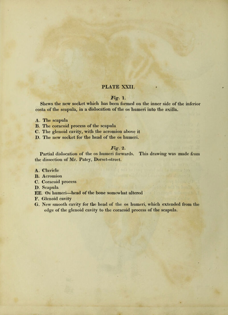 ■■X. A JT, I PLATE XXII. Fig. 1. Shews the new socket which has been formed on the inner side of the inferior costa of the scapula, in a dislocation of the os humeri into the axilla. A. The scapula B. The coracoid process of the scapula C. The glenoid cavity, with the acromion above it D. The new socket for the head of the os humeri. Fig. 2. Partial dislocation of the os humeri forwards. This drawing was made from the dissection of Mr. Patey, Dorset-street. A. Clavicle B. Acromion C. Coracoid process D. Scapula EE. Os humeri—head of the bone somewhat altered F. Glenoid cavity G. New smooth cavity for the head of the os humeri, which extended from tlie edge of the glenoid cavity to the coracoid process of the scapula.