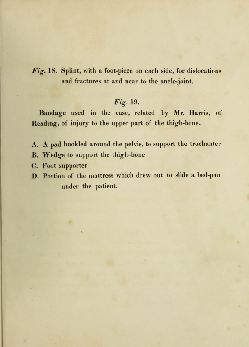 Fig. 18. Splint, with a foot-piece on each side, for dislocations and fractures at and near to the ancle-joint. Fig. 19. Bandage used in the case, related by Mr. Harris, of Reading, of injury to the upper part of the thigh-bone. A. A pad buckled around the pelvis, to support the trochanter B. Wedge to support the thigh-bone C. Foot supporter D. Portion of the mattress which drew out to slide a bed-pan under the patient.