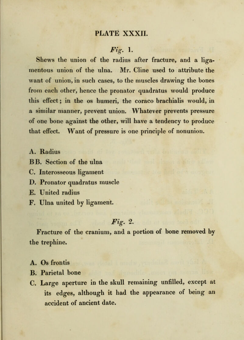 Fig, 1. Shews the union of the radius after fracture, and a liga- mentous union of the ulna. Mr. Cline used to attribute the want of union, in such cases, to the muscles drawing the bones from each other, hence the pronator quadratus would produce this effect; in the os humeri, the coraco brachialis would, in a similar manner, prevent union. Whatever prevents pressure of one bone against the other, will have a tendency to produce that effect. Want of pressure is one principle of nonunion. A. Radius BB. Section of the ulna C. Interosseous ligament D. Pronator quadratus muscle E. United radius F. Ulna united by ligament. Fig. 2. Fracture of the cranium, and a portion of bone removed by the trephine. A. Os frontis B. Parietal bone C. Large aperture in the skull remaining unfilled, except at its edges, although it had the appearance of being an accident of ancient date.