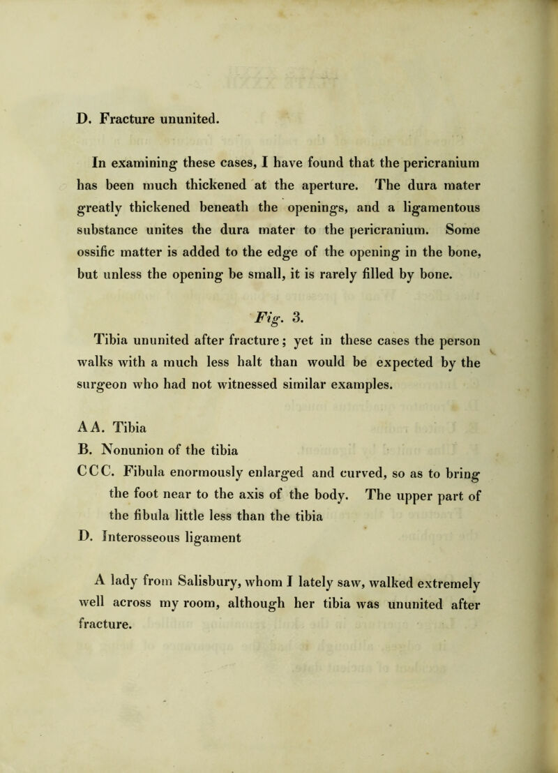 D, Fracture unuiiited. In examining these cases, I have found that the pericranium has been much thickened at the aperture. The dura mater greatly thickened beneath the openings, and a ligamentous substance unites the dura mater to the pericranium. Some ossific matter is added to the edge of the opening in the bone, but unless the opening be small, it is rarely filled by bone. Fig, 3. Tibia ununited after fracture; yet in these cases the person walks with a much less halt than would be expected by the surgeon who had not witnessed similar examples. A A. Tibia B. Nonunion of the tibia CCC. Fibula enormously enlarged and curved, so as to bring the foot near to the axis of the body. The upper part of the fibula little less than the tibia D. Interosseous ligament A lady from Salisbury, whom I lately saw, walked extremely well across my room, although her tibia was ununited after fracture.