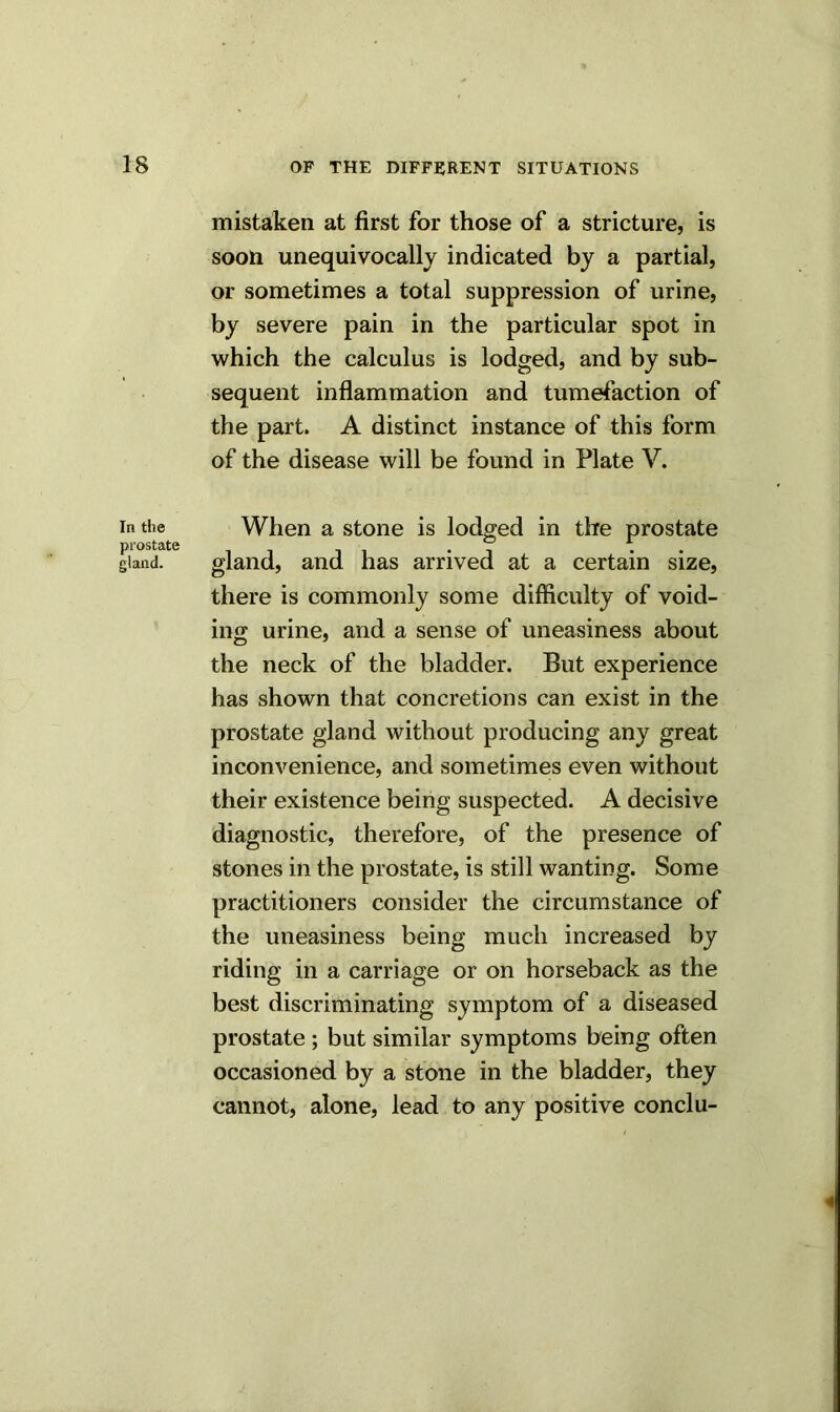 In the prostate gland. mistaken at first for those of a stricture, is soon unequivocally indicated by a partial, or sometimes a total suppression of urine, by severe pain in the particular spot in which the calculus is lodged, and by sub- sequent inflammation and tumefaction of the part. A distinct instance of this form of the disease will be found in Plate V. When a stone is lodged in the prostate gland, and has arrived at a certain size, there is commonly some difficulty of void- ing urine, and a sense of uneasiness about the neck of the bladder. But experience has shown that concretions can exist in the prostate gland without producing any great inconvenience, and sometimes even without their existence being suspected. A decisive diagnostic, therefore, of the presence of stones in the prostate, is still wanting. Some practitioners consider the circumstance of the uneasiness being much increased by riding in a carriage or on horseback as the best discriminating symptom of a diseased prostate ; but similar symptoms being often occasioned by a stone in the bladder, they cannot, alone, lead to any positive conclu-