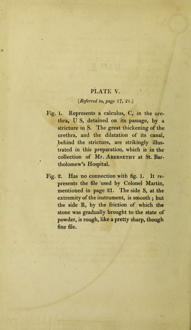 {Referred to, page 17, 21.) Fig. 1. Represents a calculus, C, in the ure- thra, U S, detained on its passage, by a stricture in S. The great thickening of the urethra, and the dilatation of its canal, behind the stricture, are strikingly illus- trated in this preparation, which is in the collection of Mr. Abernethy at St. Bar- tholomew’s Hospital. Fig. 2. Has no connection with fig. 1. It re- presents the file used by Colonel Martin, mentioned in page 21. The side S, at the extremity of the instrument, is smooth ; but the side R, by the friction of which the stone was gradually brought to the state of powder, is rough, like a pretty sharp, though fine file.