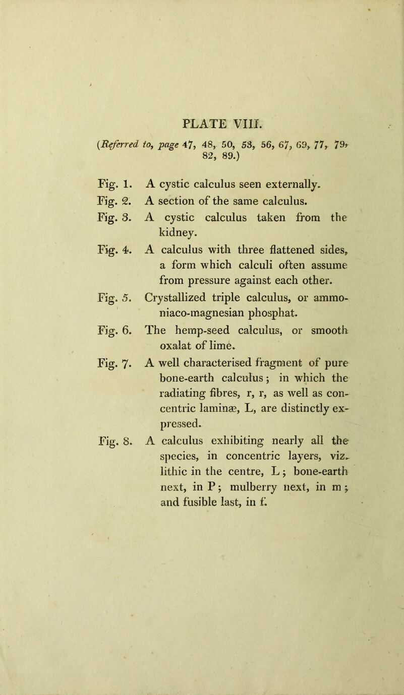 (.Referred to, page 47, 48, 50, 53, 56, 67, 69, 77, 79’ 82, 89.) Fig. 1. A cystic calculus seen externally. Fig. 2. A section of the same calculus. Fig. 3. A cystic calculus taken from the kidney. Fig. 4. A calculus with three flattened sides, a form which calculi often assume from pressure against each other. Fig. 5. Crystallized triple calculus, or ammo- niaco-magnesian phosphat. Fig. 6. The hemp-seed calculus, or smooth oxalat of lime. Fig. 7* A well characterised fragment of pure bone-earth calculus; in which the radiating fibres, r, r, as well as con- centric laminae, L, are distinctly ex- pressed. Fig. 8. A calculus exhibiting nearly all the species, in concentric layers, viz. lithic in the centre, L; bone-earth next, in P; mulberry next, in m; and fusible last, in f.