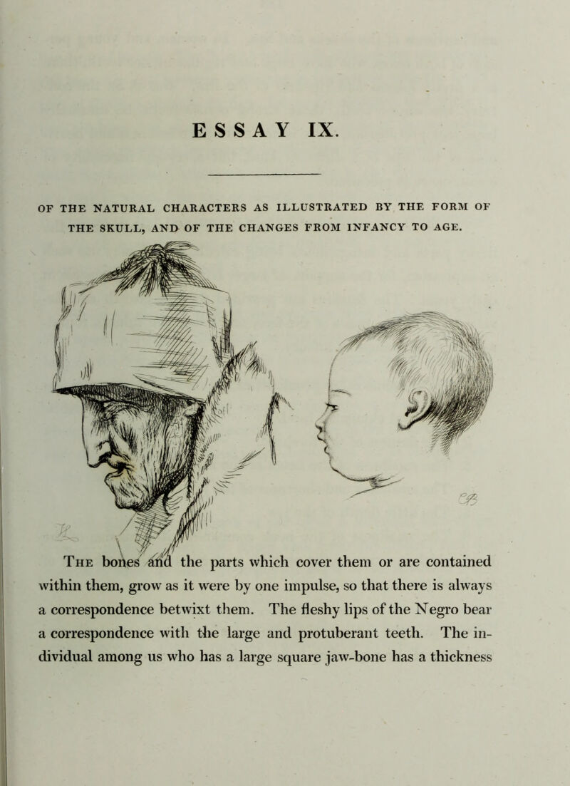 OF THE NATURAL CHARACTERS AS ILLUSTRATED BY THE FORM OF THE SKULL, AND OF THE CHANGES FROM INFANCY TO AGE. The bones and the parts which cover them or are contained within them, grow as it were by one impulse, so that there is always a correspondence betwixt them. The fleshy lips of' the Negro bear a correspondence with the large and protuberant teeth. The in- dividual among us who has a large square jaw-bone has a thickness