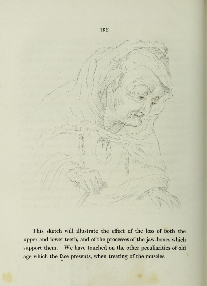 This sketch will illustrate the effect of the loss of both the upper and lower teeth, and of the processes of the jaw-bones which support them. We have touched on the other peculiarities of old age which the face presents, when treating of the muscles.