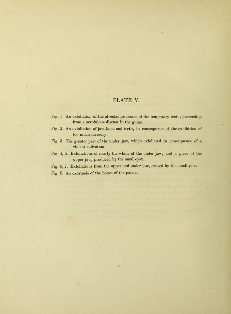 Fig. 1. An exfoliation of the alveolar processes of the temporary teeth, proceeding from a scrofulous disease in the gums. Fig. 2. An exfoliation of jaw-bone and teeth, in consequence of the exhibition of too much mercury. Fig. 3. The greater part of the under jaw, which exfoliated in consequence of a violent salivation. Fig. 4, 5. Exfoliations of nearly the whole of the under jaw, and a piece of the upper jaw, produced by the small-pox. Fig. 6, 7. Exfoliations from the upper and under jaw, caused by the small-pox. Fig. 8. An exostosis of the bones of the palate.