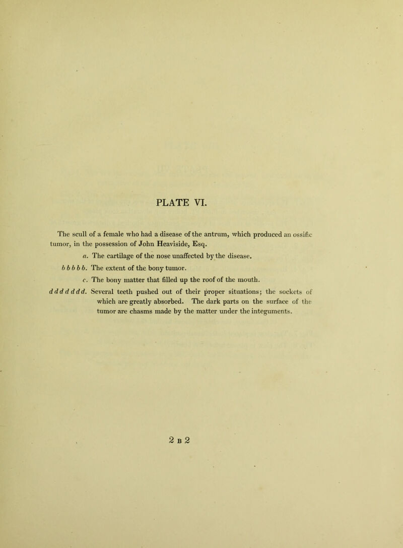 The scull of a female who had a disease of the antrum, which produced an ossific tumor, in the possession of John Heaviside, Esq. a. The cartilage of the nose unaffected by the disease. bbbbb. The extent of the bony tumor. c. The bony matter that filled up the roof of the mouth. d d d d d dd. Several teeth pushed out of their proper situations; the sockets of which are greatly absorbed. The dark parts on the surface of the tumor are chasms made by the matter under the integuments. 2 B 2