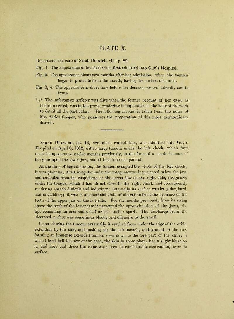 Represents the case of Sarah Dulwich, vide p. 89. Fig. 1. The appearance of her face when first admitted into Guy’s Hospital. Fig. 2. The appearance about two months after her admission, when the tumour began to protrude from the mouth, having the surface ulcerated. Fig. 3, 4. The appearance a short time before her decease, viewed laterally and in front. * The unfortunate sufferer was alive when the former account of her case, as before inserted, was in the press, rendering it impossible in the body of the work to detail all the particulars. The following account is taken from the notes of Mr. Astley Cooper, who possesses the preparation of this most extraordinary disease. Sarah Dulwich, set. 13, scrofulous constitution, was admitted into Guy’s Hospital on April 8, 1812, with a large tumour under the left cheek, which first made its appearance twelve months previously, in the form of a small tumour of the gum upon the lower jaw, and at that time not painful. At the time of her admission, the tumour occupied the whole of the left cheek ; it was globular; it felt irregular under the integuments; it projected below the jaw, and extended from the cuspidatus of the lower jaw on the right side, irregularly under the tongue, which it had thrust close to the right cheek, and consequently rendering speech difficult and indistinct; internally its surface was irregular, hard, and unyielding; it was in a superficial state of ulceration from the pressure of the teeth of the upper jaw on the left side. For six months previously from its rising above the teeth of the lower jaw it prevented the approximation of the jaws, the lips remaining an inch and a half or two inches apart. The discharge from the ulcerated surface was sometimes bloody and offensive to the smell. Upon viewing the tumour externally it reached from under the edge of the orbit, extending by the side, and pushing up the left nostril, and around to the ear, forming an immense extended tumour even down to the fore part of the chin; it was at least half the size of the head, the skin in some places had a slight blush on it, and here and there the veins were seen of considerable size running over its surface.