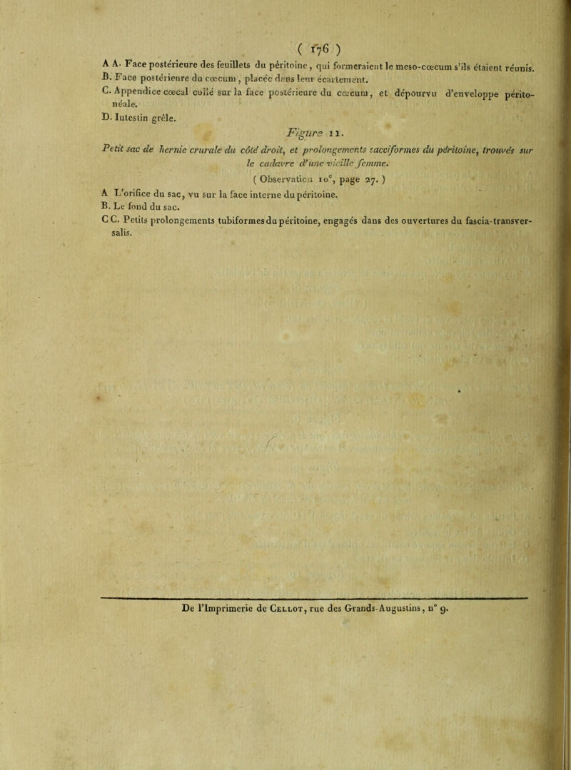 ( *76 ) A A- Face postérieure des feuillets du péritoine , qui formeraient le meso-cœcum s’ils étaient réunis. B. Face postérieure du cæcum , placée dans leur écartement. C. Appendice coecal coiié sur la face postérieure du cæcum, et dépourvu d’enveloppe périto- néale. D. Intestin grêle. Figure xi. Petit sac de hernie crurale du côté droit, et prolongements sacciformes du péritoine, trouvés sur le cadavre d'une vieille femme. ( Observation 10e, page 27. ) A L’orifice du sac, vu sur la face interne du péritoine. B. Le fond du sac. CC. Petits prolongements tubiformes du péritoine, engagés dans des ouvertures du fascia-transver- sale. De l’Imprimerie de Cellot, rue des Grands-Auguslins, n° 9.