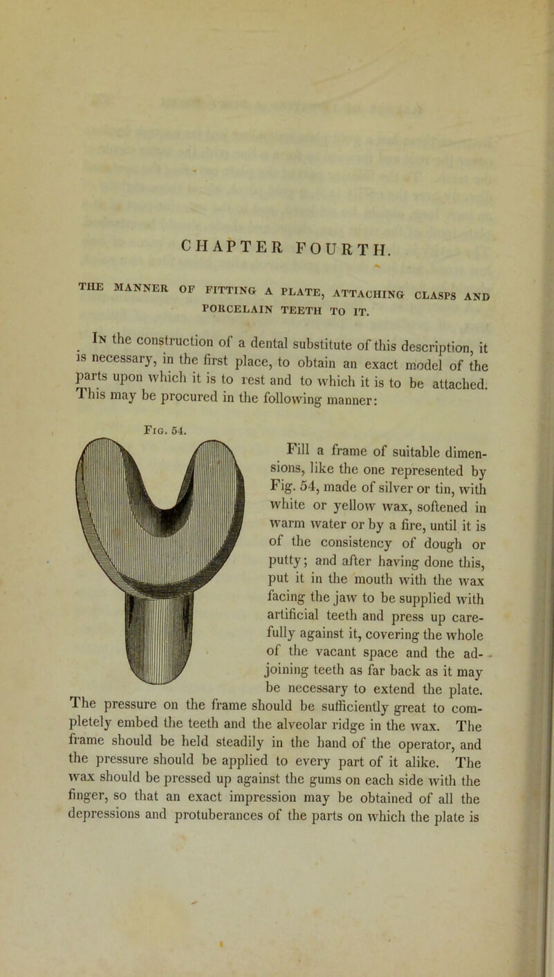 CHAPTER FOURTH. THE MANNER OF FITTING A PLATE, ATTACHING CLASPS AND PORCELAIN TEETH TO IT. . In construction of a dental substitute of this description, it is necessary, in the first place, to obtain an exact model of the parts upon which it is to rest and to which it is to be attached. This may be procured in the following manner: Fig. 54. Fill a frame of suitable dimen- sions, like the one represented by Fig. 54, made of silver or tin, with white or yellow wax, softened in warm water or by a fire, until it is of the consistency of dough or putty; and after having done this, put it in the mouth with the wax facing the jaw to be supplied with artificial teeth and press up care- fully against it, covering the whole of the vacant space and the ad- . joining teeth as far back as it may be necessary to extend the plate. The pressure on the frame should be sufficiently great to com- pletely embed the teeth and the alveolar ridge in the wax. The frame should be held steadily in the hand of the operator, and the pressure should be applied to every part of it alike. The wax should be pressed up against the gums on each side with the finger, so that an exact impression may be obtained of all the depressions and protuberances of the parts on which the plate is