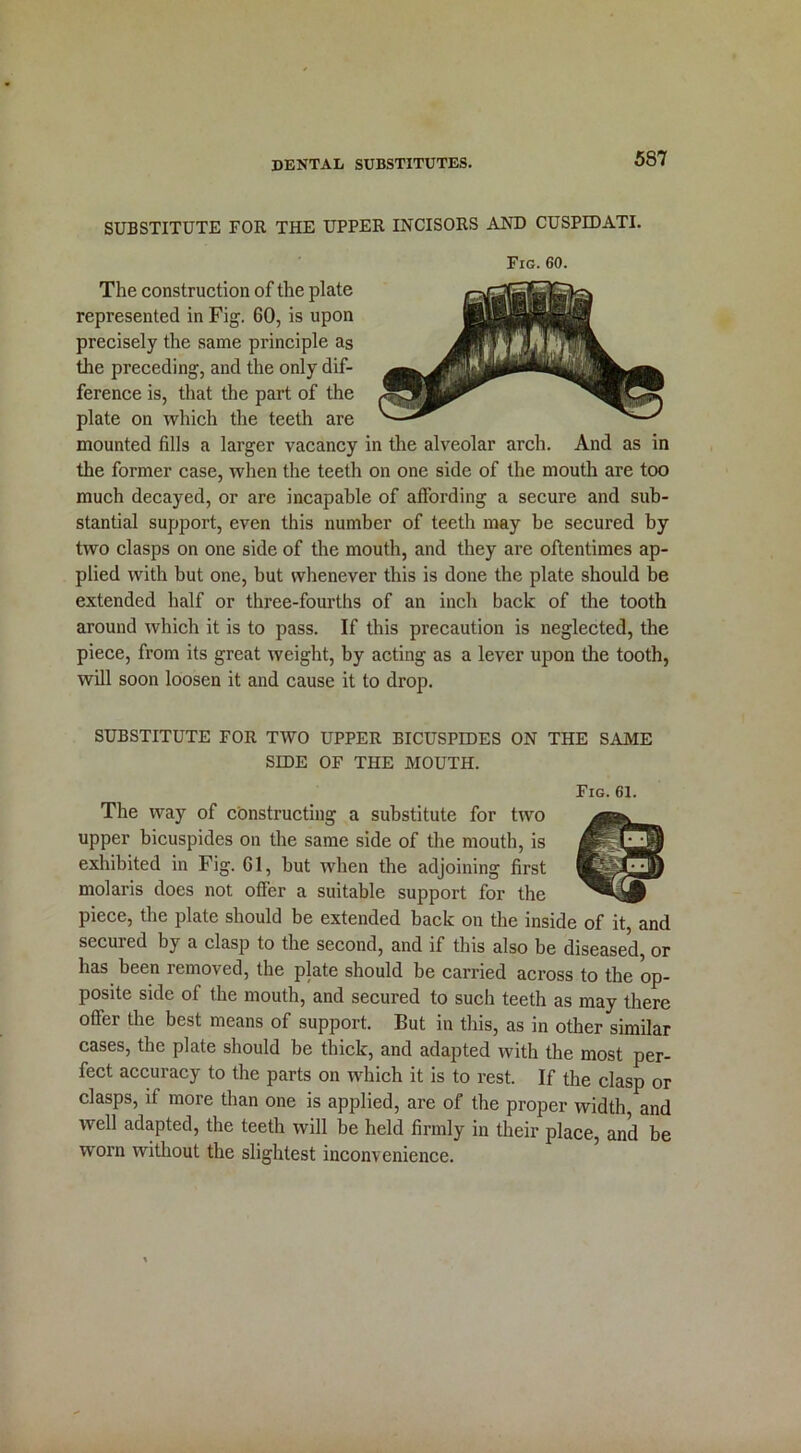 dental substitutes. SUBSTITUTE FOR THE UPPER INCISORS AND CUSPIDATE Fig. 60. The construction of the plate represented in Fig. 60, is upon precisely the same principle as the preceding, and the only dif- ference is, that the part of the plate on which the teeth are mounted fills a larger vacancy in the alveolar arch. And as in the former case, when the teeth on one side of the mouth are too much decayed, or are incapable of affording a secure and sub- stantial support, even this number of teeth may be secured by two clasps on one side of the mouth, and they are oftentimes ap- plied with but one, but whenever this is done the plate should be extended half or three-fourths of an inch back of the tooth around which it is to pass. If this precaution is neglected, the piece, from its great weight, by acting as a lever upon the tooth, will soon loosen it and cause it to drop. SUBSTITUTE FOR TWO UPPER BICUSPIDES ON THE SAME SIDE OF THE MOUTH. Fig. 61. The way of constructing a substitute for two upper bicuspides on the same side of the mouth, is exhibited in Fig. 61, but when the adjoining first molaris does not offer a suitable support for the piece, the plate should be extended back on the inside of it, and secured by a clasp to the second, and if this also be diseased, or has been removed, the plate should be carried across to the op- posite side of the mouth, and secured to such teeth as may there offer the best means of support. But in this, as in other similar cases, the plate should be thick, and adapted with the most per- fect accuracy to the parts on which it is to rest. If the clasp or clasps, if more than one is applied, are of the proper width, and well adapted, the teeth will be held firmly in their place, and be worn without the slightest inconvenience.