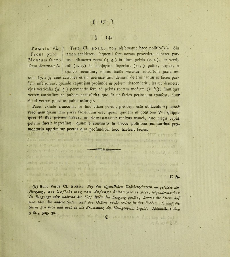 14. Pos-itto VI. Frons pubi. Mentum facro. Dem Schemate A. Teste Cl. .boer, non ob fervatur haec pofitio(kj). Sin tamen accideret, fequenti fere norma procedere deberet par- tus : diametro recta (4. 5.) in linea pelvis (r. s.~), et verti- cali (2.3.) in conjugata fuperiore (<?./!) pofita, caput, a trunco retentum, minus facile vertitur antrorfum juxta ar- cum (y. 2 ); contractiones etiam uterinae tum demum determinantur in faciei par- inferiorem, quando caput jam profunde in pelvim descenderit, ita ut diameter ejus verticalis (2. 3.) pervenerit fere ad pelvis rectam mediam (/. /z.), fimulqua vertex antrorfum ad pubem accesftrit; quo fit ut facies perinaeum tranfeat, dum* fimul vertex pone os pubis asfurgat. Patet exinde truncum, in hoc etiam partu, princeps esfe obftaculum; quod vero neutiquam tatn parvi faciendum est, quam quidem in pofitione Va: quippe quae id fibi privum habet, ut- deminuatur renixus trunci, quo magis caput pelvim fuerit ingresfum, quum e contrario in hacce pofitione eo fortium prt>- snontorio apprimitur pectus quo profundiori loco haeferit facies» C A- (k) Sunt Verba Ch boer: Bey den eigentHchen Gefichtsgeburten — gefchiet der- Hergang, das Ge/icht mag vom Anfange fiehen wie es will, foigendermas/en? Im Eingattge oder wahrend der Kopf dtrfch den Eingang pasfirt, kommt die Stirne au/ ei ne oder die andere Se i te, und das Geficht rnckt weiter in das Becken fo das/ die,- Stirne fich nach und nach in die Krummung des Heiligenbeins begibt.. Abhandl, 1 B*.„ 3 St., pag. 30» C