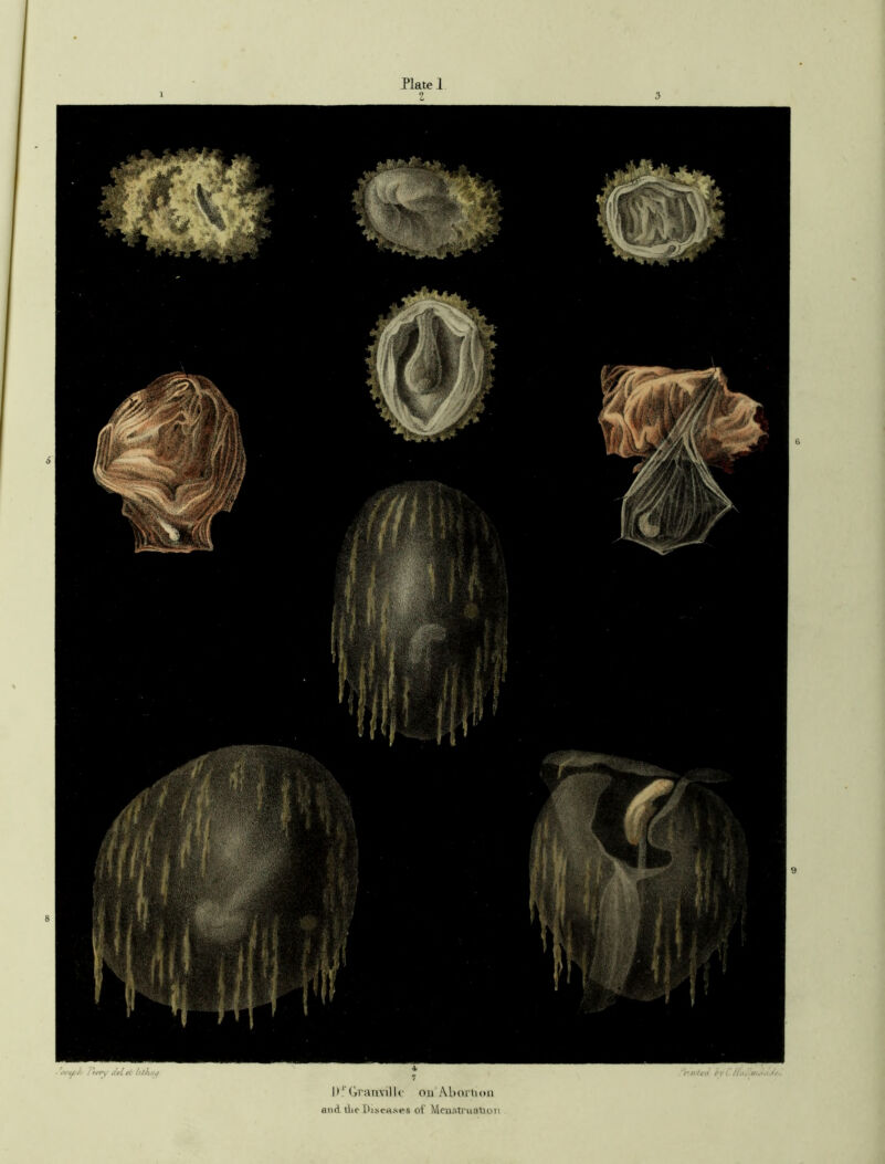 ' T/y (l Uthoif ‘ir/t'tfo /'i‘ C I>1 Granville on Abortion and the Diseases ol Menstruation