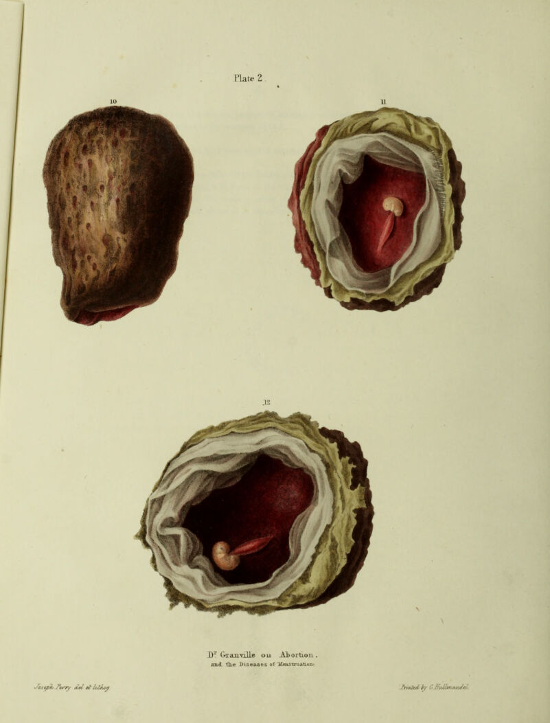 Dr Granville ou Abortion . and. tile diseases of Itenstruatioji' ■/ojtp/is F&rry M ct fatkoy Initiwi fry C HuMm,MuUl.