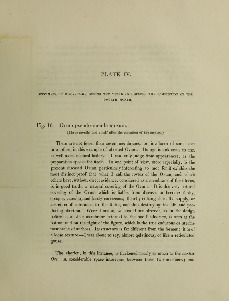 SPECIMENS OF MISCARRIAGE DURING THE THIRD AND BEFORE THE COMPLETION OF THE FOURTH MONTH. Fig. 16. Ovum pseudo-membranosum. (Three months and a half after the cessation of the menses.) There are not fewer than seven membranes, or involucra of some sort or another, in this example of aborted Ovum. Its age is unknown to me, as well as its medical history. I can only judge from appearances, as the preparation speaks for itself. In one point of view, more especially, is the present diseased Ovum particularly interesting to me; for it exhibits the most distinct proof that what I call the cortex of the Ovum, and which others have, without direct evidence, considered as a membrane of the uterus, is, in good truth, a natural covering of the Ovum. It is this very natural covering of the Ovum which is liable, from disease, to become fleshy, opaque, vascular, and lastly coriaceous, thereby cutting short the supply, or accretion of substance to the foetus, and thus destroying its life and pro- ducing abortion. Were it not so, we should not observe, as in the design before us, another membrane external to the one I allude to, as seen at the bottom and on the right of the figure, which is the true caducous or uterine membrane of authors. Its structure is far different from the former; it is of a loose texture,—I was about to say, almost gelatinous, or like a reticulated gauze. The chorion, in this instance, is thickened nearly as much as the cortex Ovi. A considerable space intervenes between those two involucra ; and