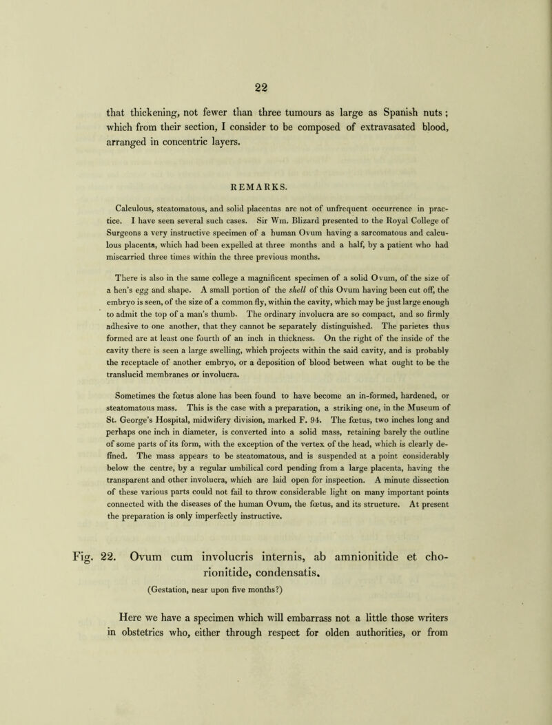 that thickening, not fewer than three tumours as large as Spanish nuts ; which from their section, I consider to be composed of extravasated blood, arranged in concentric layers. REMARKS. Calculous, steatomatous, and solid placentas are not of unfrequent occurrence in prac- tice. I have seen several such cases. Sir Wm. Blizard presented to the Royal College of Surgeons a very instructive specimen of a human Ovum having a sarcomatous and calcu- lous placenta, which had been expelled at three months and a half, by a patient who had miscarried three times within the three previous months. There is also in the same college a magnificent specimen of a solid Ovum, of the size of a hen’s egg and shape. A small portion of the shell of this Ovum having been cut off, the embryo is seen, of the size of a common fly, within the cavity, which may be just large enough to admit the top of a man’s thumb. The ordinary involucra are so compact, and so firmly adhesive to one another, that they cannot he separately distinguished. The parietes thus formed are at least one fourth of an inch in thickness. On the right of the inside of the cavity there is seen a large swelling, which projects within the said cavity, and is probably the receptacle of another embryo, or a deposition of blood between what ought to be the translucid membranes or involucra. Sometimes the foetus alone has been found to have become an in-formed, hardened, or steatomatous mass. This is the case with a preparation, a striking one, in the Museum of St. George’s Hospital, midwifery division, marked F. 94. The foetus, two inches long and perhaps one inch in diameter, is converted into a solid mass, retaining barely the outline of some parts of its form, with the exception of the vertex of the head, which is clearly de- fined. The mass appears to be steatomatous, and is suspended at a point considerably below the centre, by a regular umbilical cord pending from a large placenta, having the transparent and other involucra, which are laid open for inspection. A minute dissection of these various parts could not fail to throw considerable light on many important points connected with the diseases of the human Ovum, the foetus, and its structure. At present the preparation is only imperfectly instructive. Fig. 22. Ovum cum involucris internis, ab amnionitide et cho- rionitide, condensatis. (Gestation, near upon five months?) Here we have a specimen which will embarrass not a little those writers in obstetrics who, either through respect for olden authorities, or from