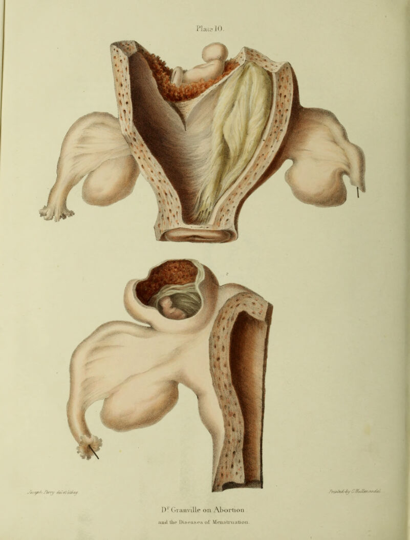 and the Diseases of Menstruation.