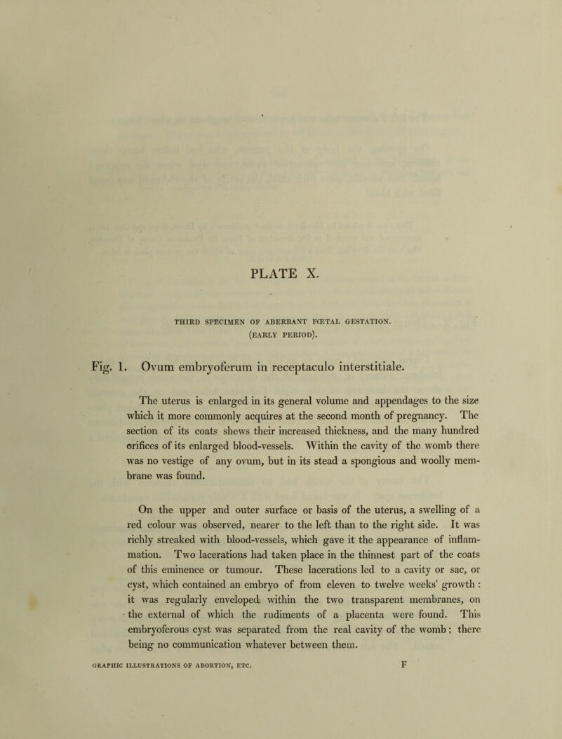 THIRD SPECIMEN OF ABERRANT FCETAL GESTATION. (EARLY period). Fig. 1. Ovum embryoferum in receptaculo interstitiale. The uterus is enlarged in its general volume and appendages to the size which it more commonly acquires at the second month of pregnancy. The section of its coats shews their increased thickness, and the many hundred orifices of its enlarged blood-vessels. Within the cavity of the womb there was no vestige of any ovum, but in its stead a spongious and woolly mem- brane was found. On the upper and outer surface or basis of the uterus, a swelling of a red colour was observed, nearer to the left than to the right side. It was richly streaked with blood-vessels, which gave it the appearance of inflam- mation. Two lacerations had taken place in the thinnest part of the coats of this eminence or tumour. These lacerations led to a cavity or sac, or cyst, which contained an embryo of from eleven to twelve weeks’ growth : it was regularly enveloped within the two transparent membranes, on the external of which the rudiments of a placenta were found. This embryoferous cyst was separated from the real cavity of the womb; there being no communication whatever between them. GRAPHIC ILLUSTRATIONS OF ABORTION, ETC. F