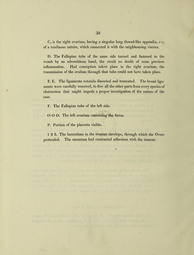 38 C, is the right ovarium, having a singular long thread-like appendix, c c, of a tendinous nature, which connected it with the neighbouring viscera. D. The Fallopian tube of the same side turned and fastened to the womb by an adventitious band, the result no doubt of some previous inflammation. Had conception taken place in the right ovarium, the transmission of the ovulum through that tube could not have taken place. E E. The ligamenta rotunda dissected and truncated. The broad liga- ments were carefully removed, to free all the other parts from every species of obstruction that might impede a proper investigation of the nature of the case. F. The Fallopian tube of the left side. OOO. The left ovarium containing the foetus. P. Portion of the placenta visible. 12 3. The lacerations in the ovarian envelope, through which the Ovum protruded. The omentum had contracted adhesions with the tumour.