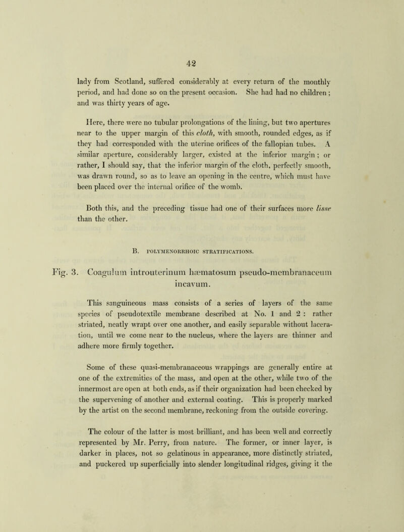 lady from Scotland, suffered considerably at every return of the monthly period, and had done so on the present occasion. She had had no children ; and was thirty years of age. Here, there were no tubular prolongations of the lining, but two apertures near to the upper margin of this cloth, with smooth, rounded edges, as if they had corresponded with the uterine orifices of the fallopian tubes. A similar aperture, considerably larger, existed at the inferior margin ; or rather, I should say, that the inferior margin of the cloth, perfectly smooth, was drawn round, so as to leave an opening in the centre, which must have been placed over the internal orifice of the womb. Both this, and the preceding tissue had one of their surfaces more lisftc than the other. B. FOLYMENORRHOIC STRATIFICATIONS. Fig. 3. Coagulum introuterinum haematosnm pseudo-membranaceom incavum. This sanguineous mass consists of a series of layers of the same species of pseudotextile membrane described at No. 1 and 2 : rather striated, neatly wrapt over one another, and easily separable without lacera- tion, until we come near to the nucleus, where the layers are thinner and adhere more firmly together. Some of these quasi-membranaceous wrappings are generally entire at one of the extremities of the mass, and open at the other, while two of the innermost are open at both ends, as if their organization had been checked by the supervening of another and external coating. This is properly marked by the artist on the second membrane, reckoning from the outside covering. The colour of the latter is most brilliant, and has been well and correctly represented by Mr. Perry, from nature. The former, or inner layer, is darker in places, not so gelatinous in appearance, more distinctly striated, and puckered up superficially into slender longitudinal ridges, giving it the
