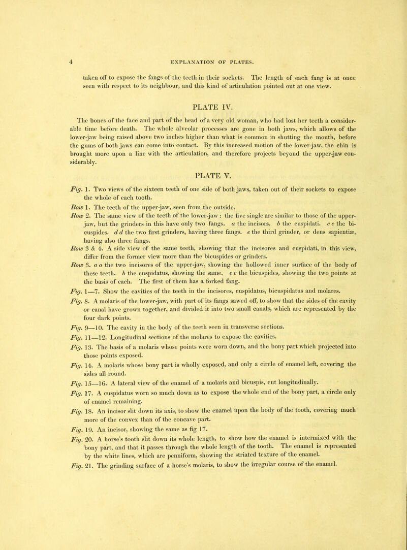taken off to expose the fangs of the teeth in their sockets. The length of each fang is at once seen with respect to its neighbour, and this kind of articulation pointed out at one view. PLATE IV. The bones of the face and part of the head of a very old woman, who had lost her teeth a consider- able time before death. The whole alveolar processes are gone in both jaws, which allows of the lower-jaw being raised above two inches higher than what is common in shutting the mouth, before the gums of both jaws can come into contact. By this increased motion of the lower-jaw, the chin is brought more upon a line with the articulation, and therefore projects beyond the upper-jaw con- siderably. PLATE V. Fig. 1. Two views of the sixteen teeth of one side of both jaws, taken out of their sockets to expose the whole of each tooth. Row 1. The teeth of the upper-jaw, seen from the outside. Row 2. The same view of the teeth of the lower-jaw: the five single are similar to those of the upper- jaw, but the grinders in this have only two fangs, a the incisors, b the cuspidati. c c the bi- cuspides. d d the two first grinders, having three fangs, e the third grinder, or dens sapientiae, having also three fangs. Row 3 & 4. A side view of the same teeth, showing that the incisores and cuspidati, in this view, differ from the former view more than the bicuspides or grinders. Row 3. a a the two incisores of the upper-jaw, showing the hollowed inner surface of the body of these teeth, b the cuspidatus, showing the same, c c the bicuspides, showing the two points at the basis of each. The first of them has a forked fang. Fig. 1—7. Show the cavities of the teeth in the incisores, cuspidatus, bicuspidatus and molares. Fig. 8. A molaris of the lower-jaw, with part of its fangs sawed off, to show that the sides of the cavity or canal have grown together, and divided it into two small canals, which are represented by the four dark points. Fig. 9—10. The cavity in the body of the teeth seen in transverse sections. Fig. 11—12. Longitudinal sections of the molares to expose the cavities. Fig. 13. The basis of a molaris whose points were worn down, and the bony part which projected into those points exposed. Fig. 14. A molaris whose bony part is wholly exposed, and only a circle of enamel left, covering the sides all round. Fig. 15—16. A lateral view of the enamel of a molaris and bicuspis, cut longitudinally. Fig. 17* A cuspidatus worn so much down as to expose the whole end of the bony part, a circle only of enamel remaining. Fig. 18. An incisor slit down its axis, to show the enamel upon the body of the tooth, covering much more of the convex than of the concave part. Fig. 19. An incisor, showing the same as fig 17. Fig. 20. A horse’s tooth slit down its whole length, to show how the enamel is intermixed with the bony part, and that it passes through the whole length of the tooth. The enamel is represented by the white lines, which are penniform, showing the striated texture of the enamel. Fig. 21. The grinding surface of a horse’s molaris, to show the irregular course of the enamel.