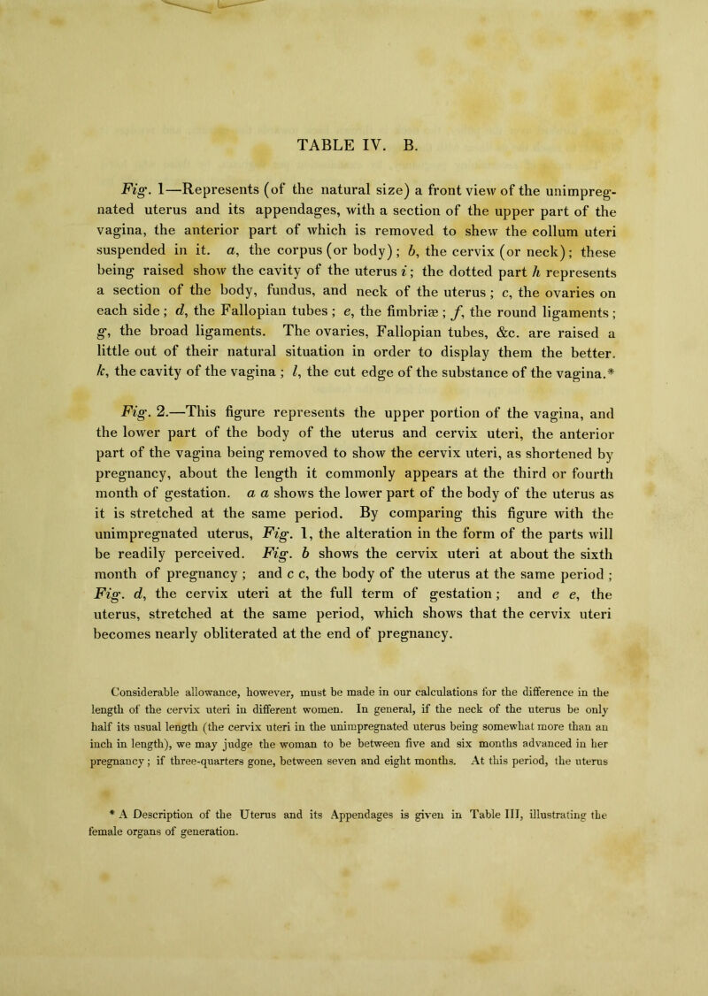 Fig. 1—Represents (of the natural size) a front view of the unimpreg- nated uterus and its appendages, with a section of the upper part of the vagina, the anterior part of which is removed to shew the collum uteri suspended in it. a, the corpus (or body); 6, the cervix (or neck); these being raised show the cavity of the uterus i; the dotted part h represents a section of the body, fundus, and neck of the uterus ; c, the ovaries on each side; d, the Fallopian tubes; e, the fimbriae ; /, the round ligaments; g, the broad ligaments. The ovaries, Fallopian tubes, &c. are raised a little out of their natural situation in order to display them the better. k, the cavity of the vagina ; Z, the cut edge of the substance of the vagina.* Fig. 2.—This figure represents the upper portion of the vagina, and the lower part of the body of the uterus and cervix uteri, the anterior part of the vagina being removed to show the cervix uteri, as shortened by pregnancy, about the length it commonly appears at the third or fourth month of gestation, a a shows the lower part of the body of the uterus as it is stretched at the same period. By comparing this figure with the unimpregnated uterus, Fig. 1, the alteration in the form of the parts will be readily perceived. Fig. b shows the cervix uteri at about the sixth month of pregnancy ; and c c, the body of the uterus at the same period ; Fig. d, the cervix uteri at the full term of gestation; and e e, the uterus, stretched at the same period, which shows that the cervix uteri becomes nearly obliterated at the end of pregnancy. Considerable allowance, however, must be made in our calculations for the difference in the length of the cervix uteri in different women. In general, if the neck of the uterus be only half its usual length (the cervix uteri in the unimpregnated uterus being somewhat more than an inch in length), we may judge the woman to be between five and six months advanced in her pregnancy ; if three-quarters gone, between seven and eight months. At this period, the uterus * A Description of the Uterus and its Appendages is given in Table III, illustrating the female organs of generation.