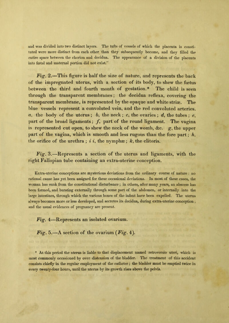 and was divided into two distinct layers. The tufts of vessels of which the placenta is consti- tuted were more distinct from each other than they subsequently become, and they filled the entire space between the chorion and decidua. The appearance of a division of the placenta into foetal and maternal portion did not exist.” Fig. 2 .—This figure is half the size of nature, and represents the back of the impregnated uterus, with a section of its body, to shew the fcetus between the third and fourth month of gestation.* The child is seen through the transparent membranes; the decidua reflexa, covering the transparent membrane, is represented by the opaque and white striae. The blue vessels represent a convoluted vein, and the red convoluted arteries, a, the body of the uterus ; 6, the neck ; c, the ovaries ; d, the tubes ; e, part of the broad ligaments; f, part of the round ligament. The vagina is represented cut open, to shew the neck of the womb, &c. g, the upper part of the vagina, which is smooth and less rugous than the fore part; h, the orifice of the urethra ; i i, the nymphae; Jc, the clitoris. Fig. 3.—Represents a section of the uterus and ligaments, with the right Fallopian tube containing an extra-uterine conception. Extra-uterine conceptions are mysterious deviations from tlie ordinary course of nature : no rational cause has yet been assigned for these occasional deviations. In most of these cases, the woman has sunk from the constitutional disturbance ; in others, after many years, an abscess has been formed, and bursting externally through some part of the abdomen, or internally into the large intestines, through which the various bones of the infant have been expelled. The uterus always becomes more or less developed, and secretes its decidua, during extra-uterine conception ; and the usual evidences of pregnancy are present. Fig. 4—Represents an isolated ovarium. Fig. 5.—A section of the ovarium (Fig. 4). * At tills period the uterus is liable to that displacement named retroversio uteri, which is most commonly occasioned by over distension of the bladder. The treatment of this accident consists chiefly in the regular employment of the catheter ; the bladder must be emptied twice in every twenty-four hours, until the uterus by its growth rises above the pelvis.